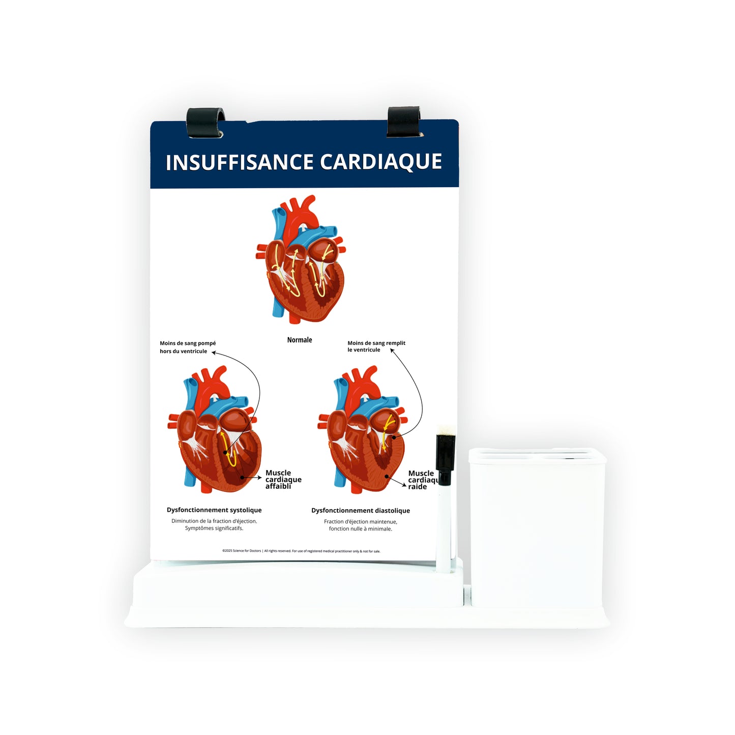 Insuffisance Cardiaque: A4 Flip wipe With Stationery Stand