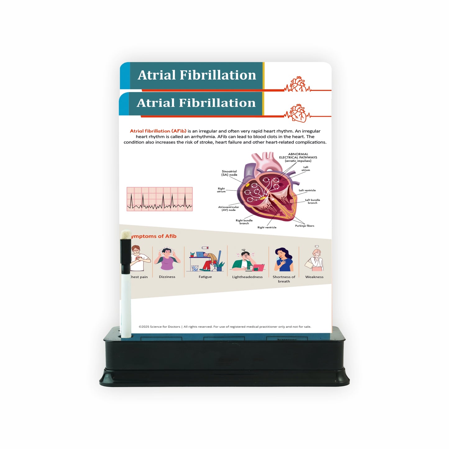 Atrial Fibrillation: 2 Slide With Stand