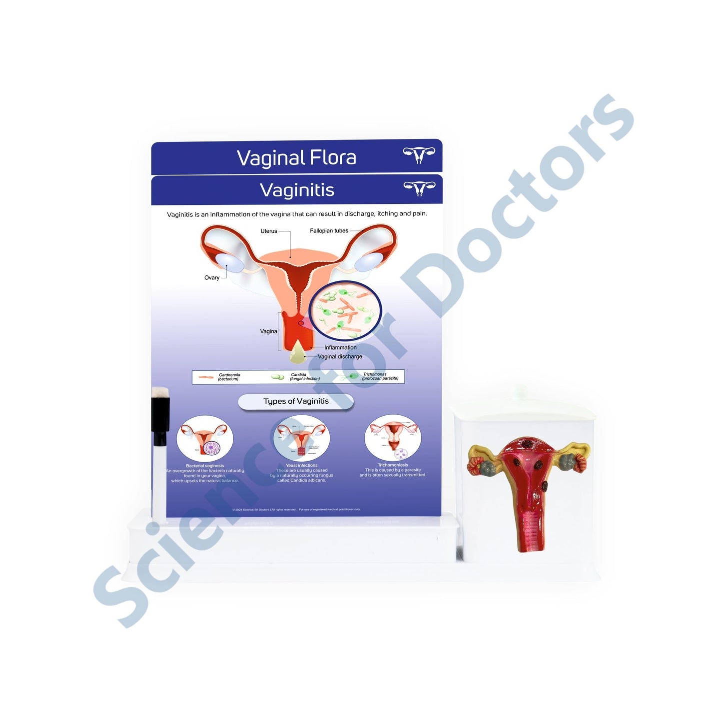 Vaginal Flora: 2 slides write & wipe with anatomical model on utility container