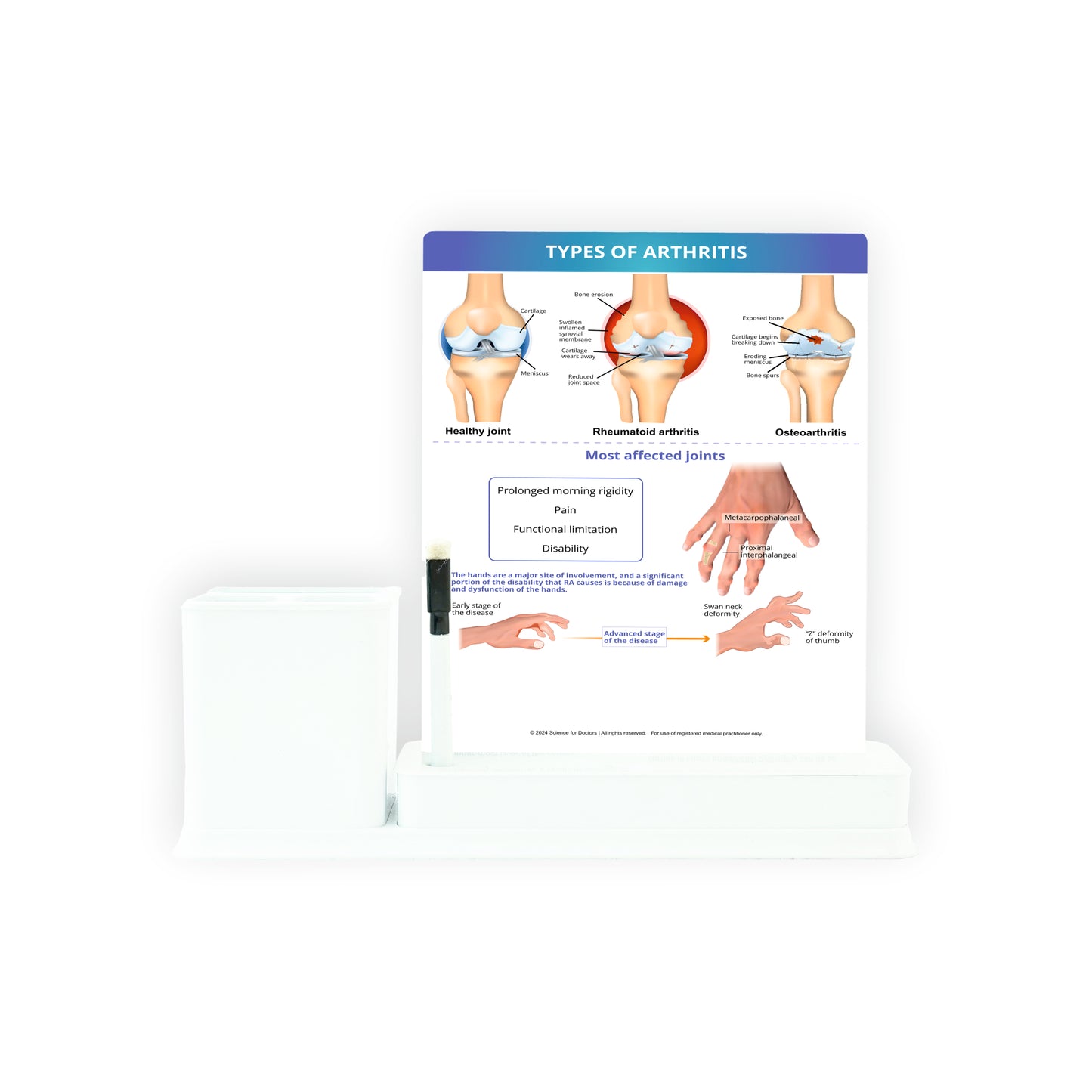 Types of Arthritis: 1 Slides Write & Wipe with Stationary Stand