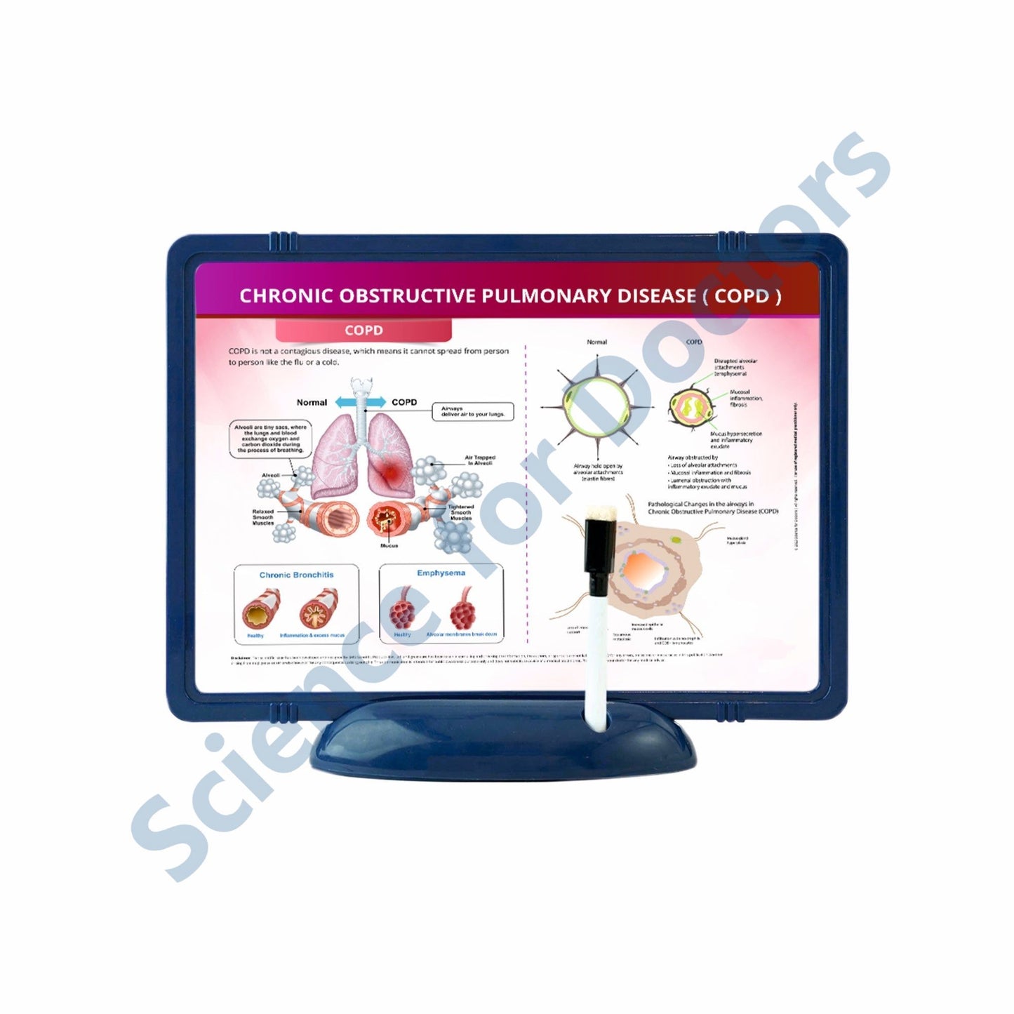 Chronic Obstructive Pulmonary Disease(COPD): The Frame Write and Wipe