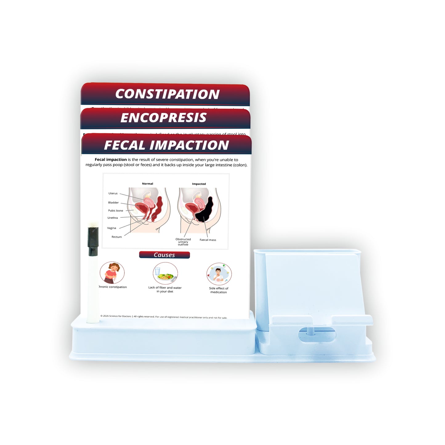 Smart - 3 Slides Write & Wipe With Mobile and Chit pad Stand - Fecal Impaction