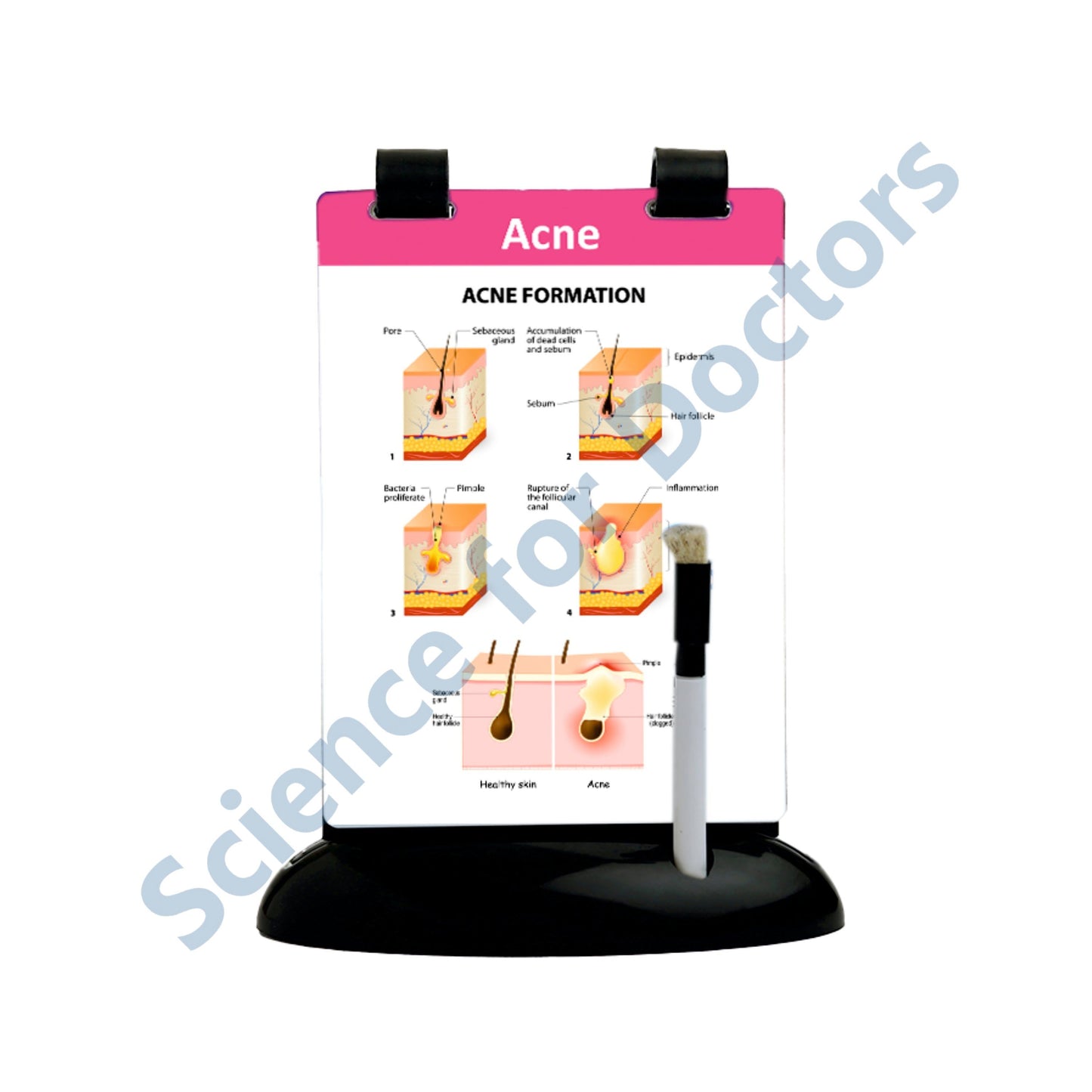 Acne: A5 Flip Wipe