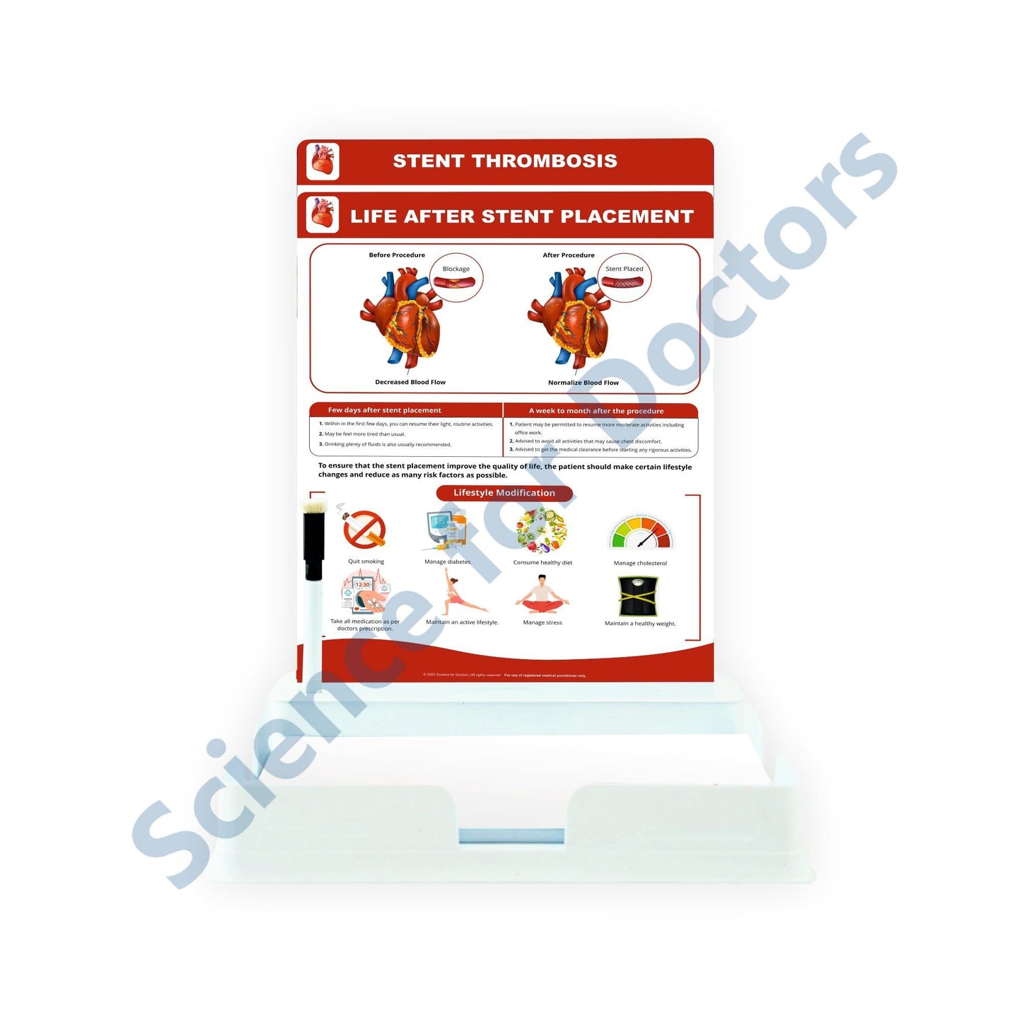 Life After Stent Placement: 2 Slides Patient Leaflet Tray