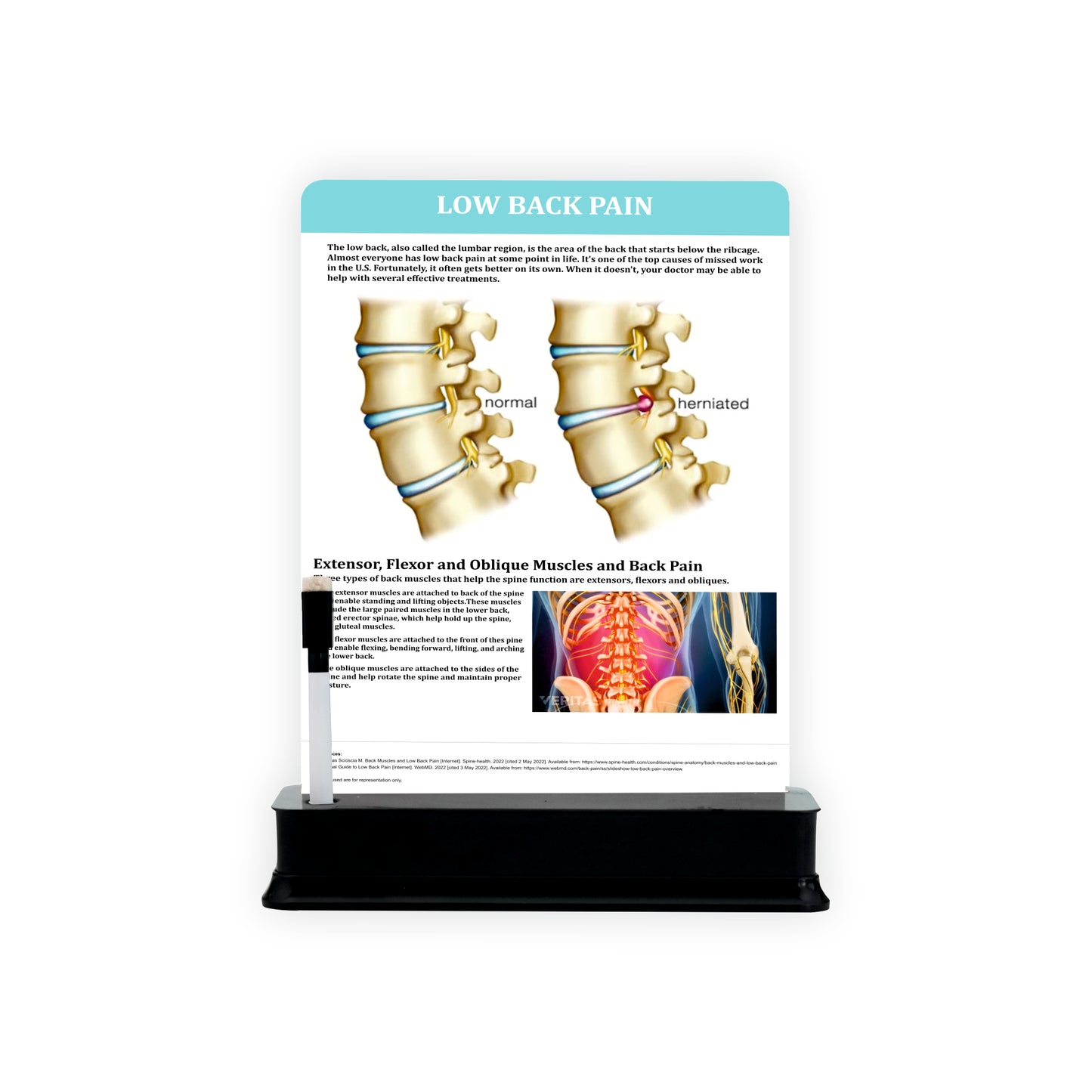 Low Back Pain: 1 Slide on stand