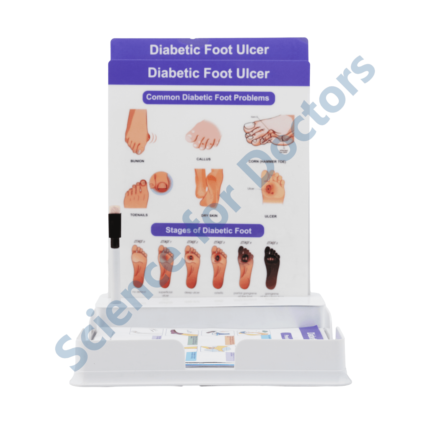 Diabetic Foot Ulcer: 2 Slides Patient Leaflet Tray