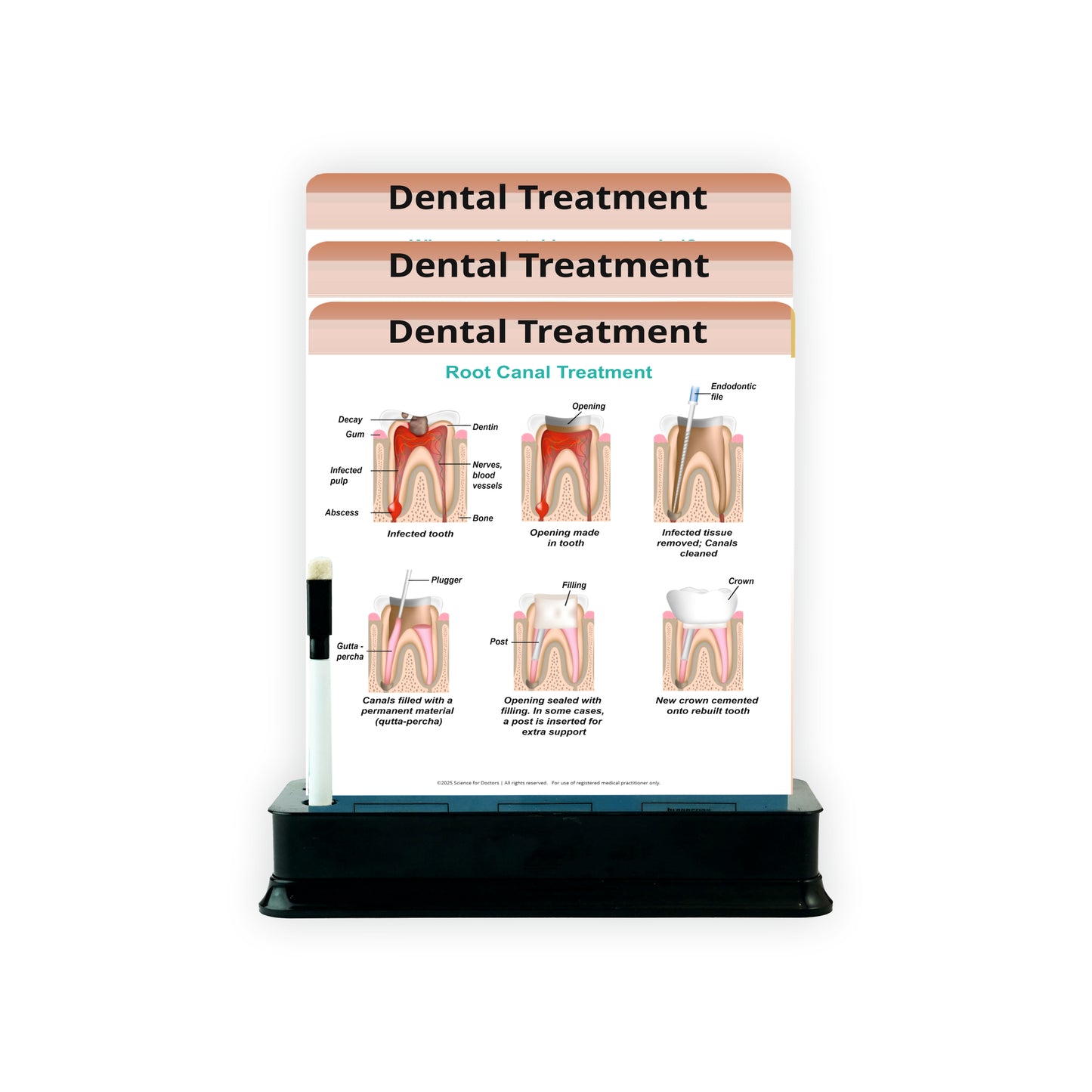 3 Slides on Stand  -  Dental Treatment