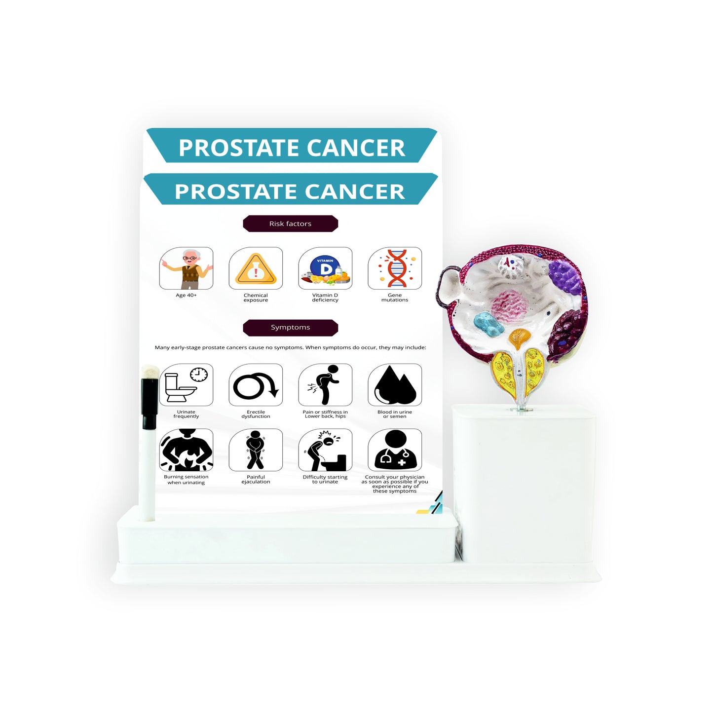 Prostate Cancer_1: 2 Slides Write and Wipe with Model On Stand
