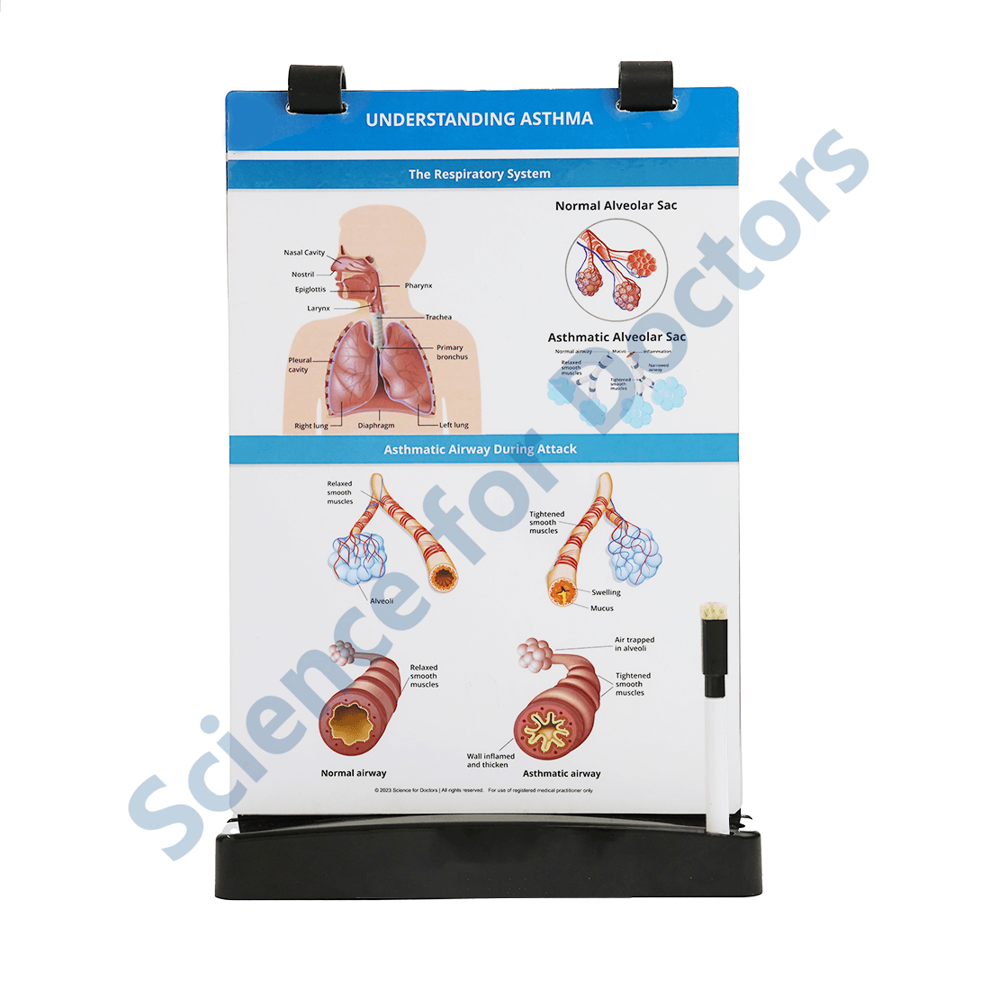 Understanding Asthma: A4 Flip Wipe