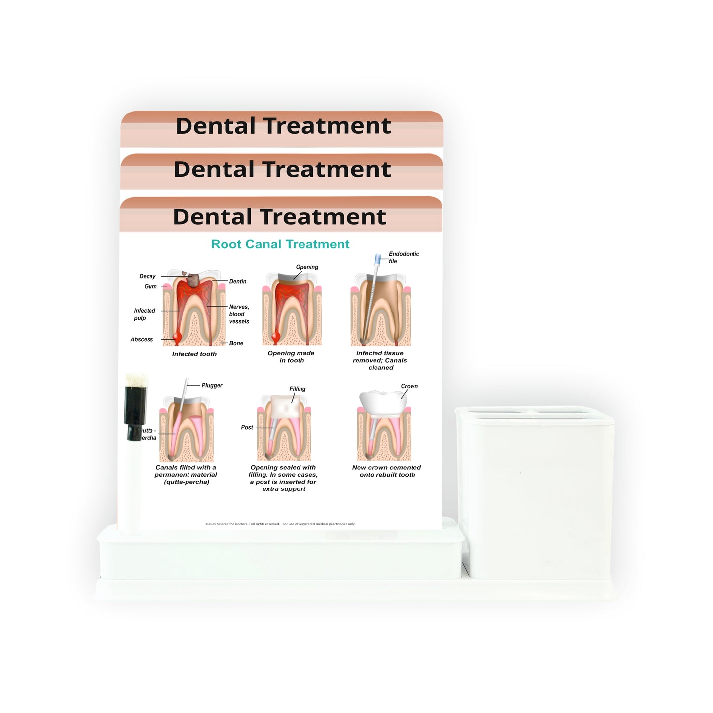 3 Slides Write & Wipe with Stationary Stand  - Dental Treatment