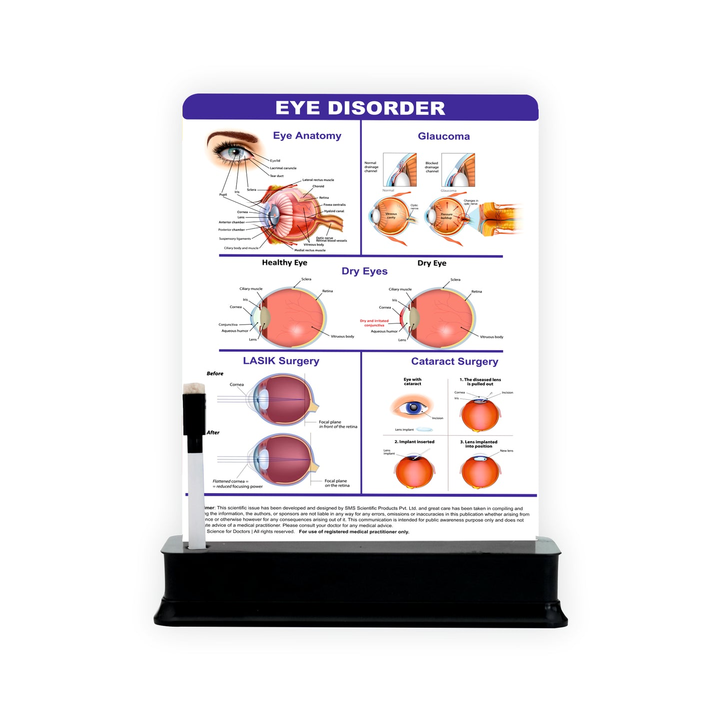 Eye Disorder - 1 Slide With Stand