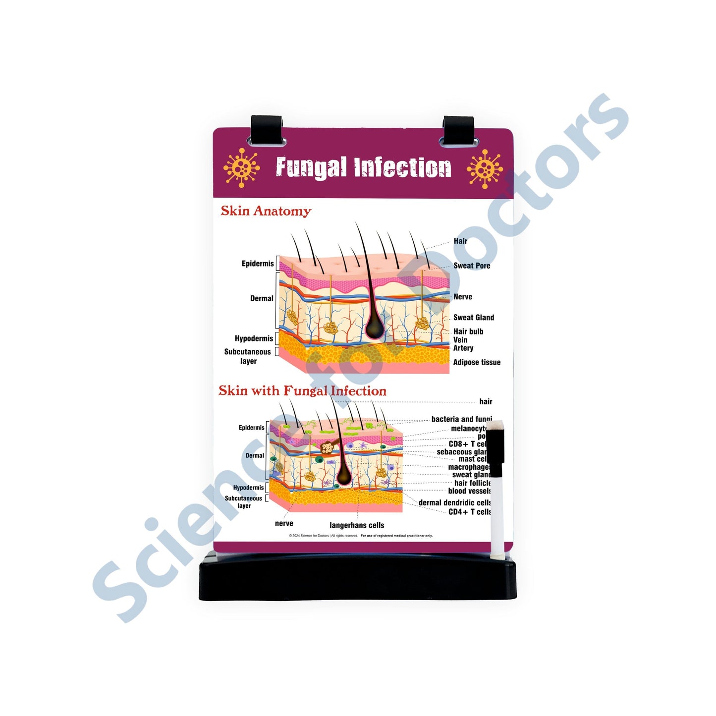 Fungal Infection: A4 Flip Wipe