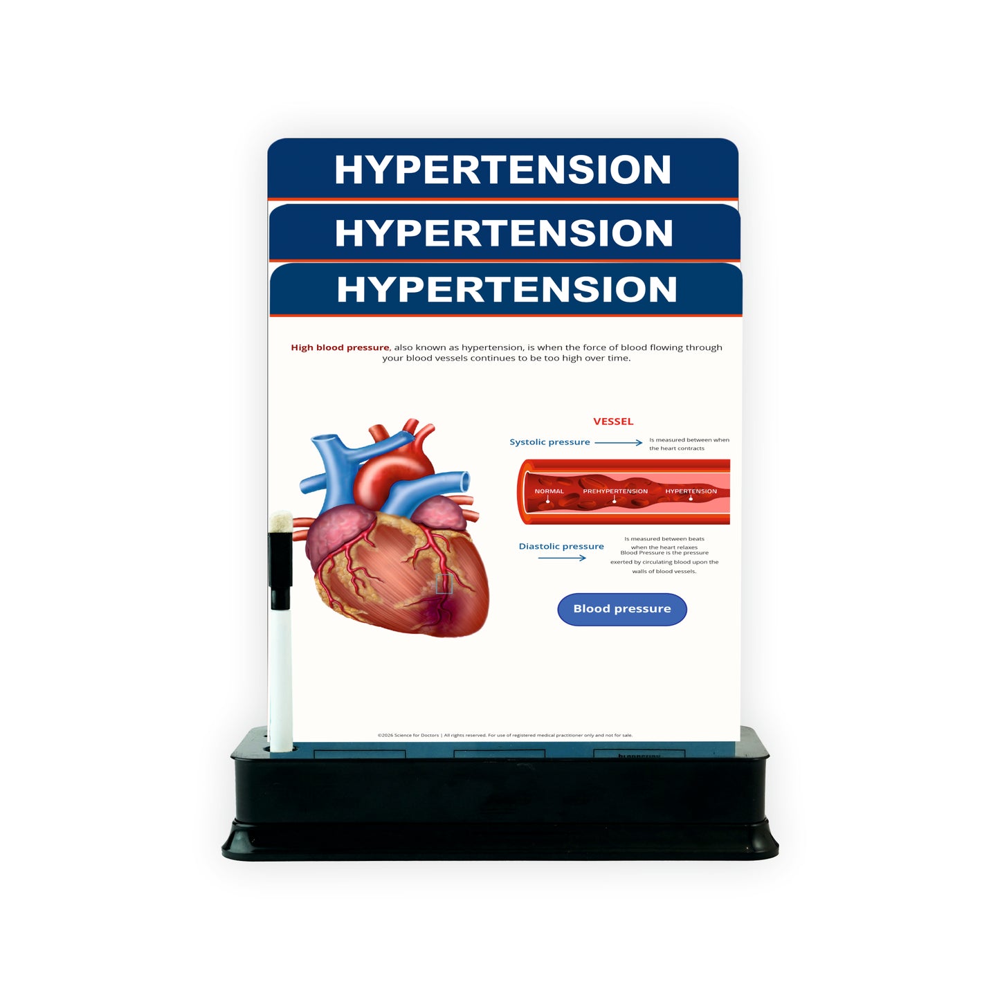 3 Slides on Stand  - Hypertension