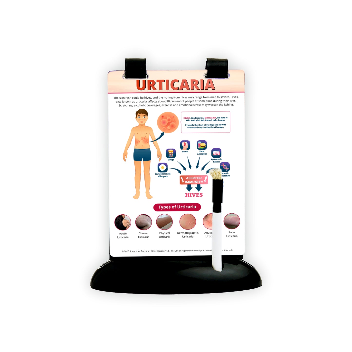 Urticaria: A5 Flip Wipe