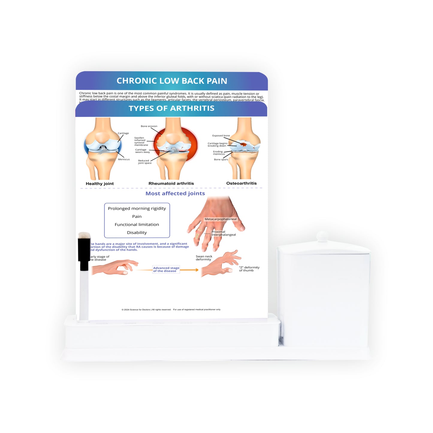 2 Slides Write & Wipe with Utility Container  - Types of Arthritis