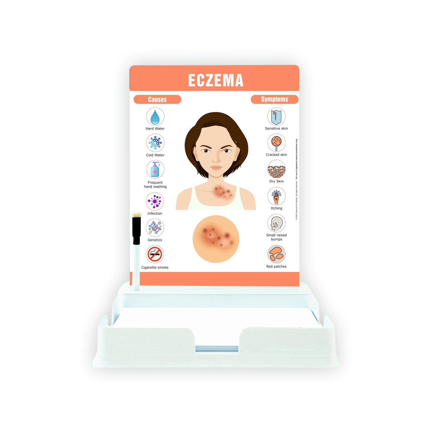 Eczema: 1 Slides With Tray