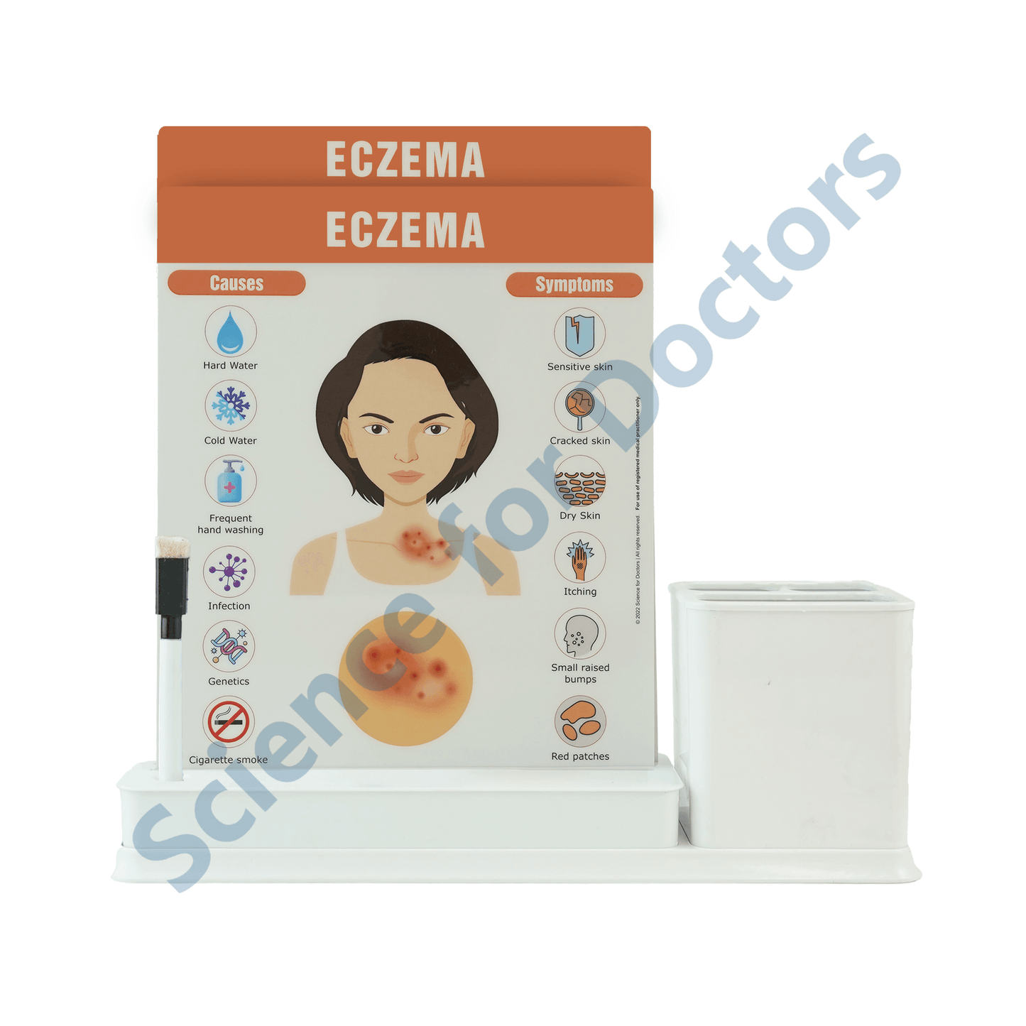 Eczema: 2 slide on stand with Stationary stand