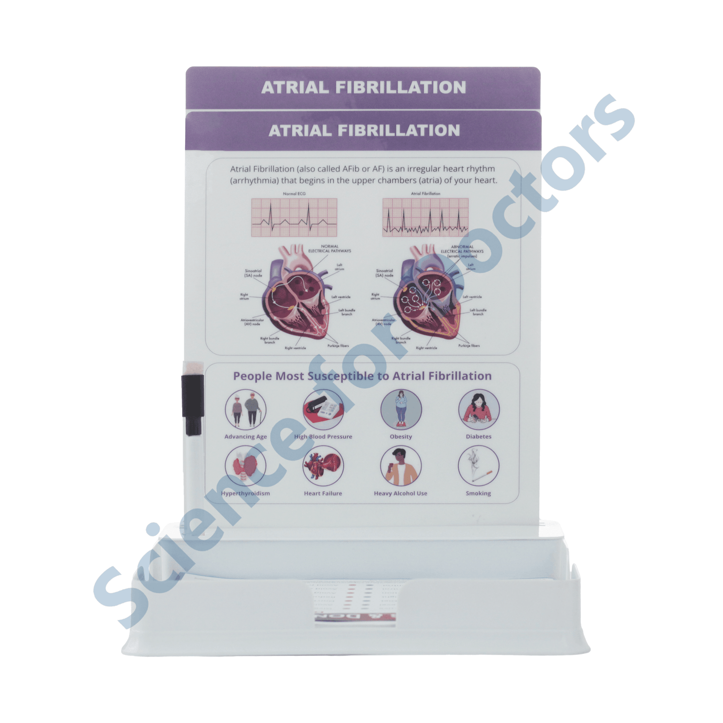 Atrial Fibrillation: 2 Slides Patient Leaflet Tray