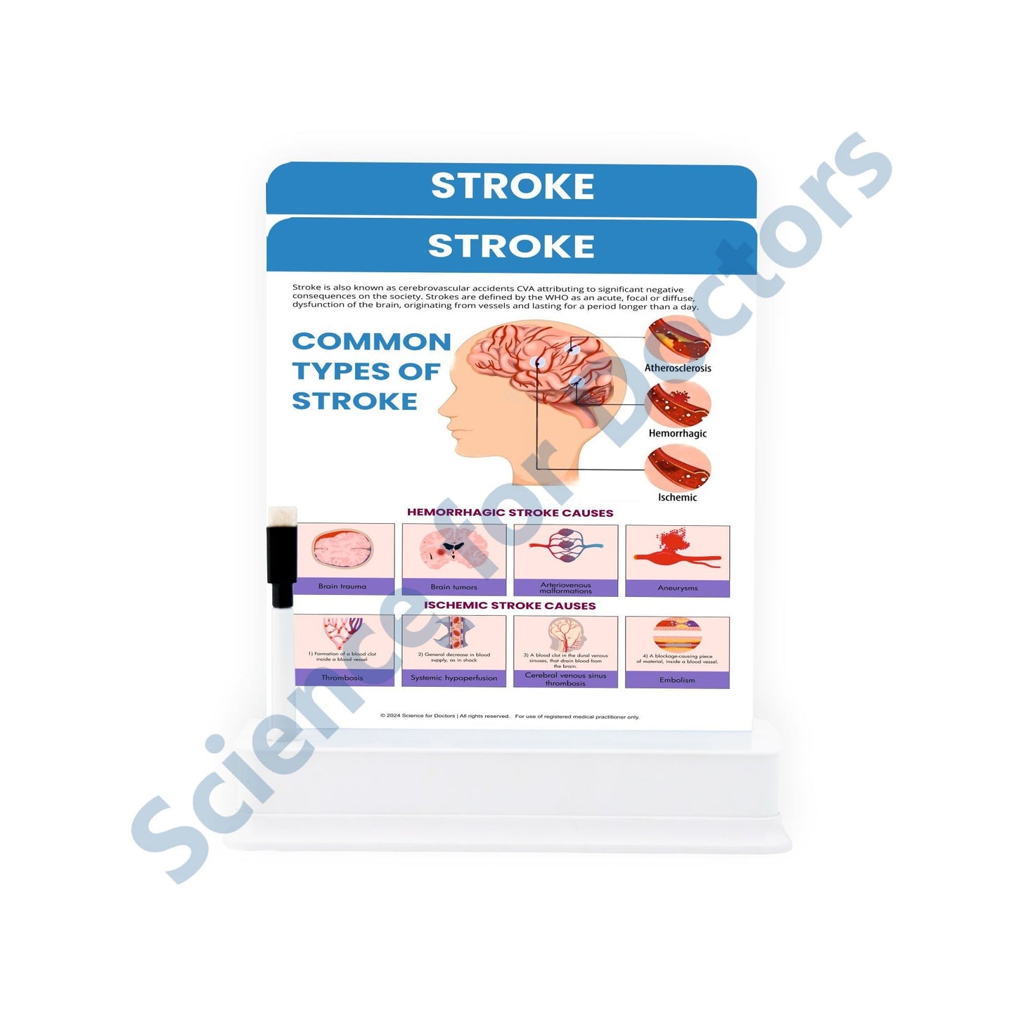 Stroke: 2 Slide on stand