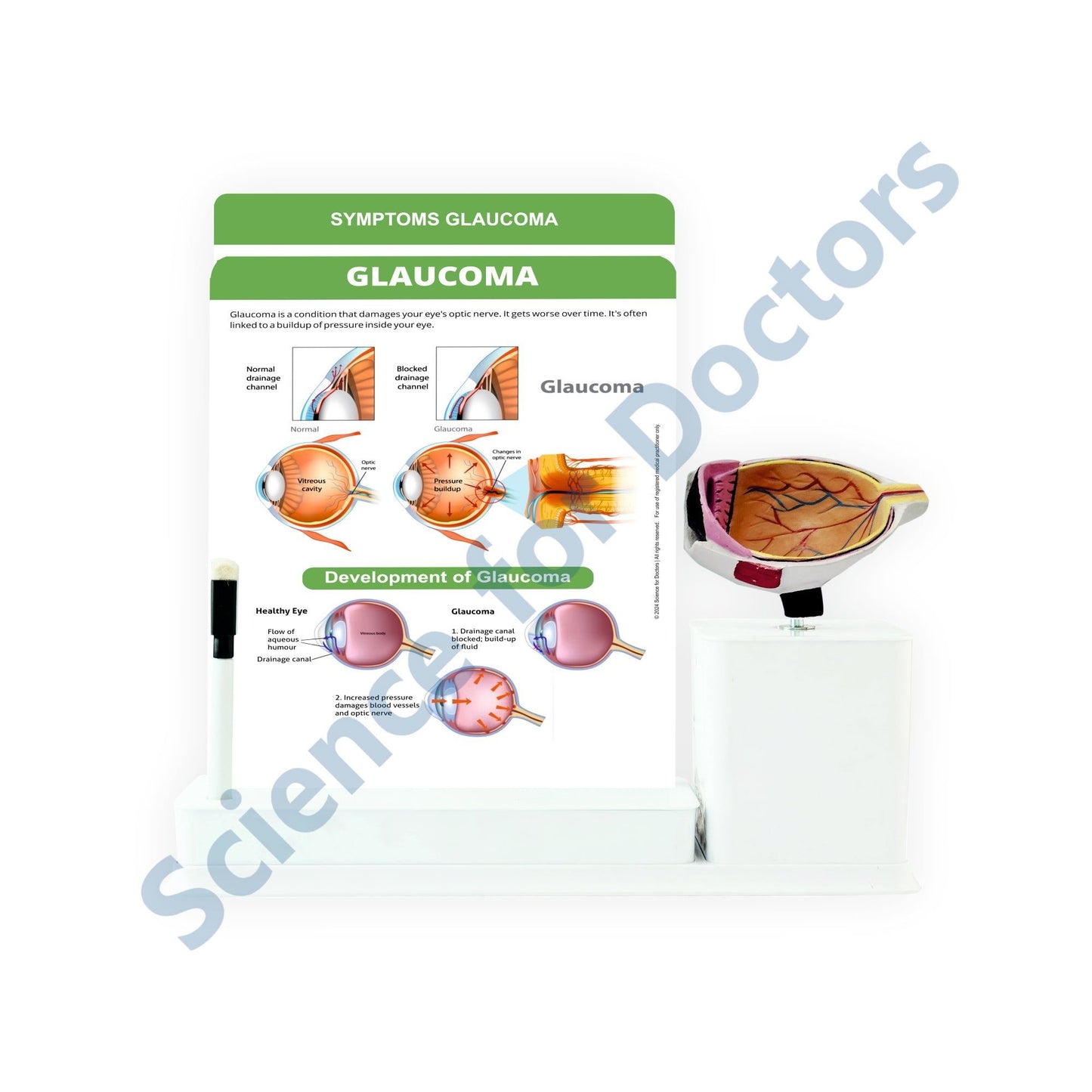 2 Slides Write and Wipe with Model On Stand - Glaucoma