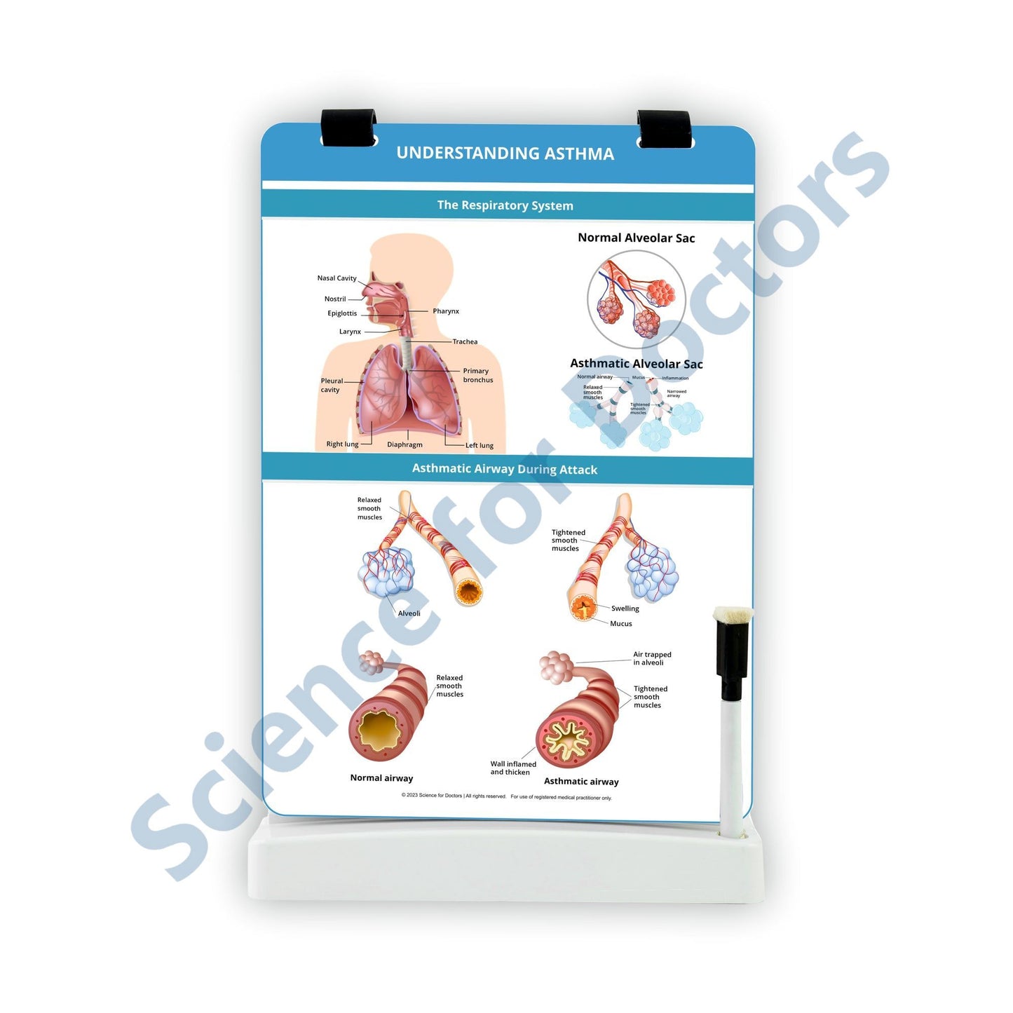 Understanding Asthma: A4 Flip Wipe