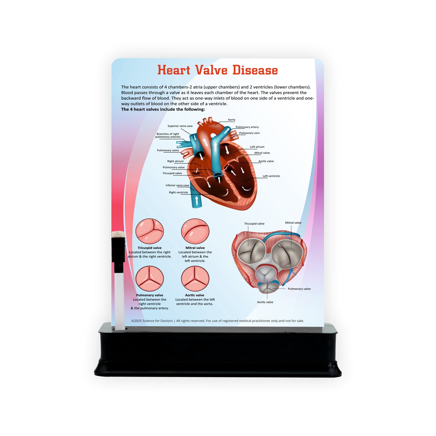 Heart Valve Disease: 1 Slide With Stand