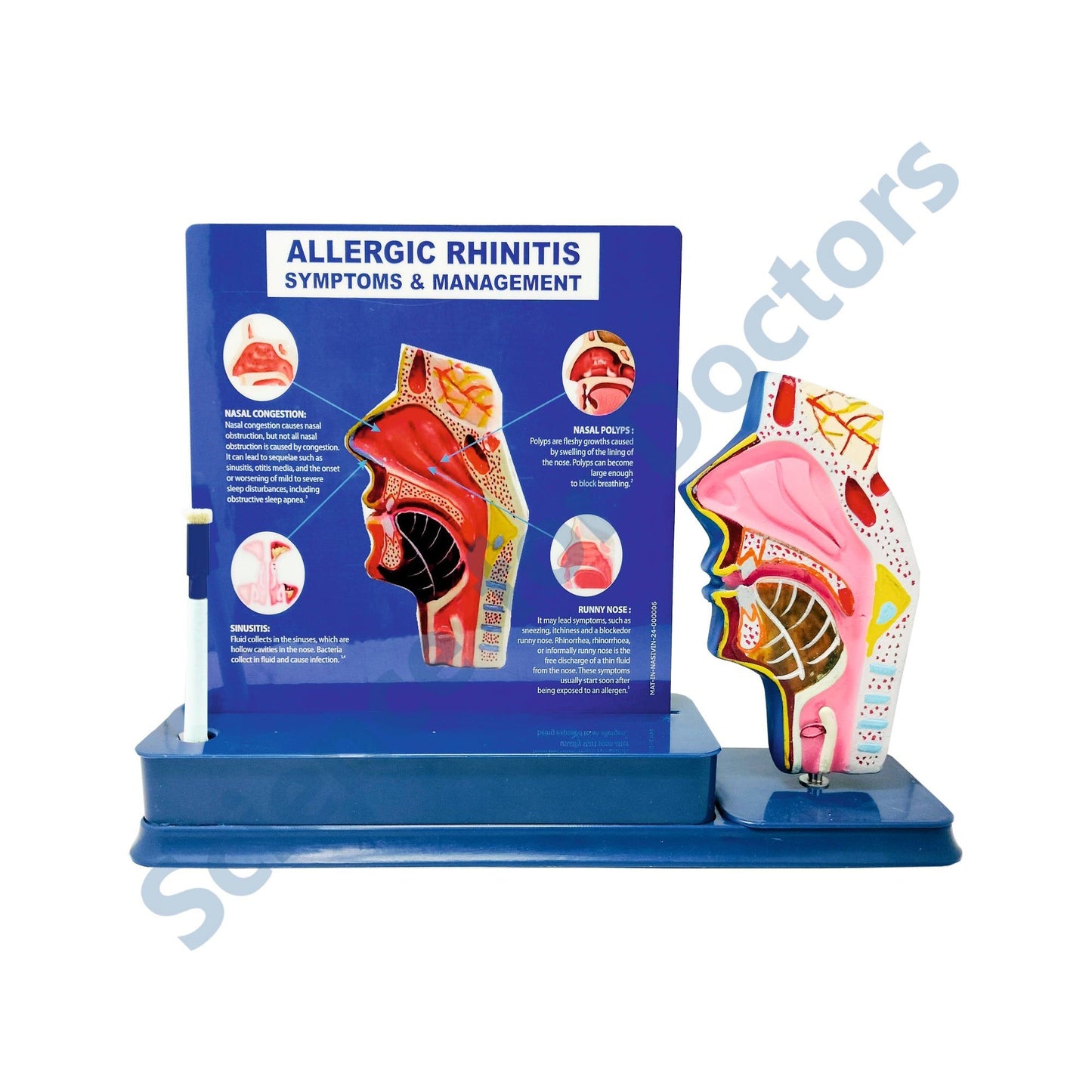 Allergic Rhinitis_1 : 1 Slide write and wipe with anatomical model on stand