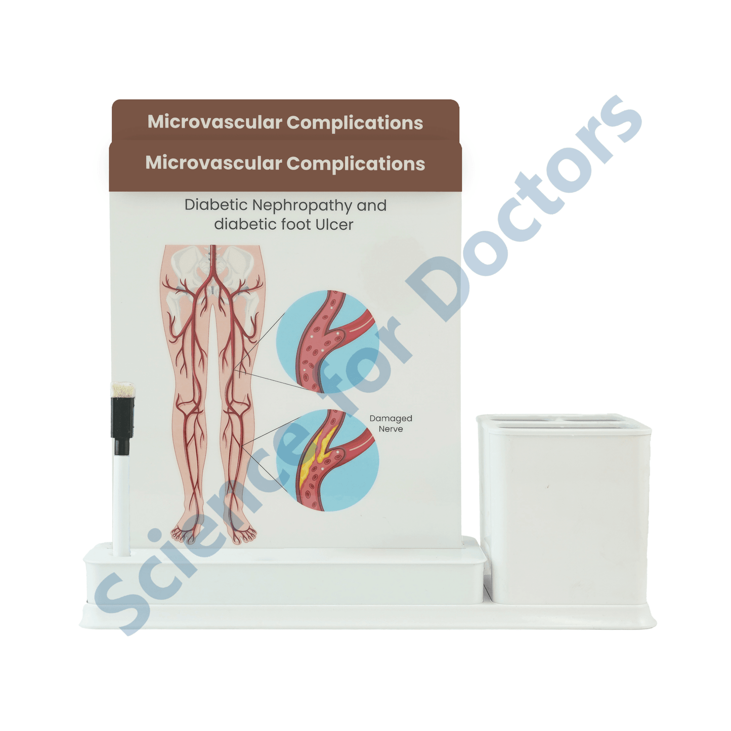 Microvascular Complications: 2 slide on stand with Stationary stand