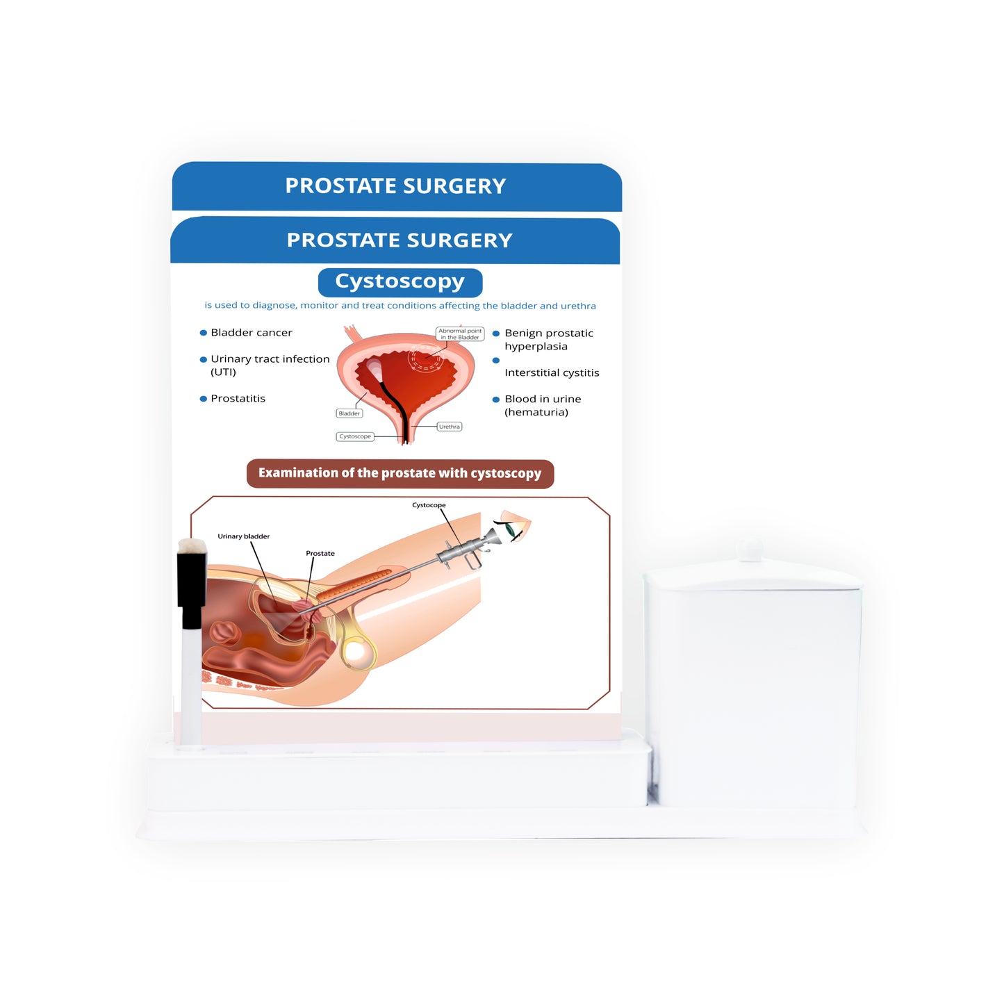 Prostate Surgery: 2 Slide Write Wipe With Utility Container