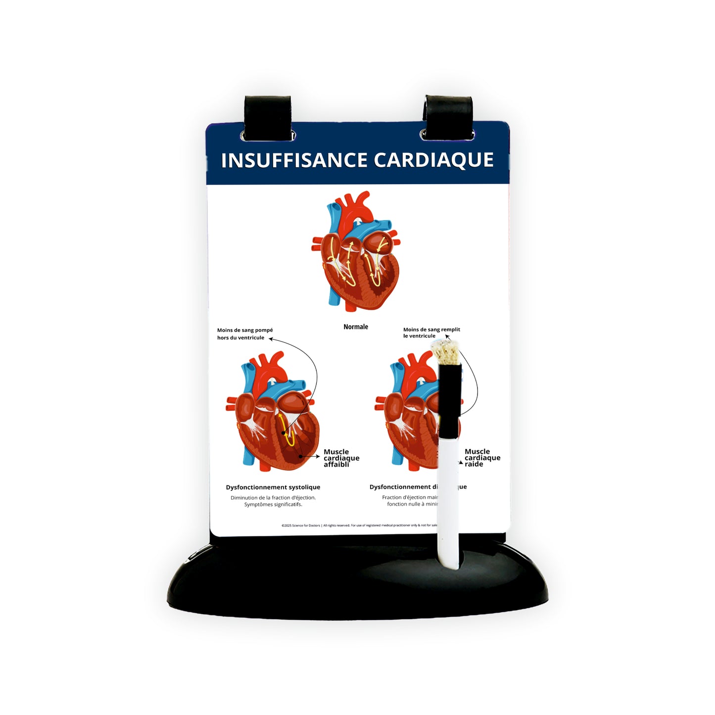 Heart Failure: A5 Flip Wipe