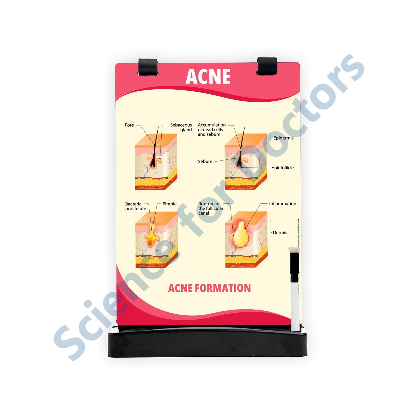 Acne: A4 Flip Wipe