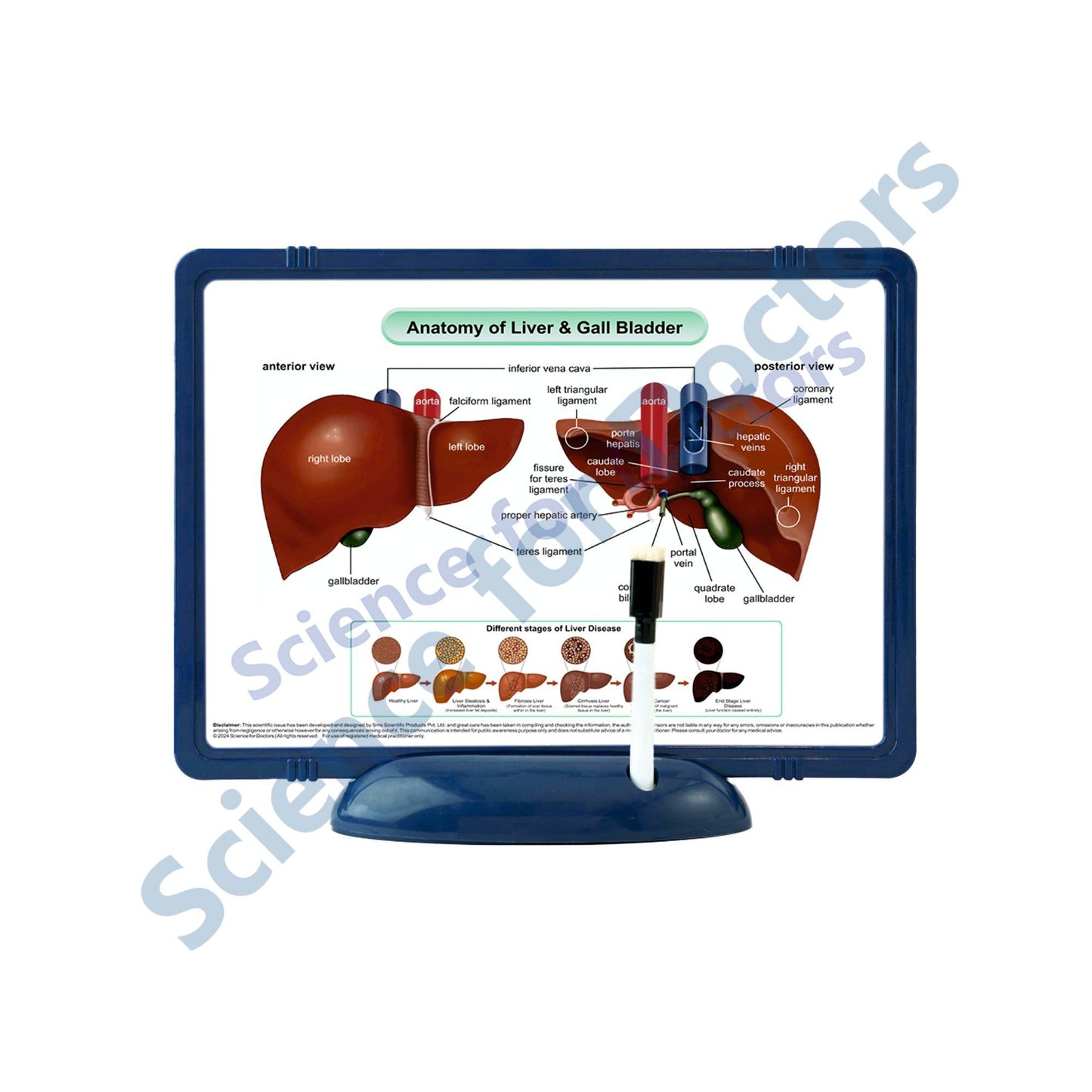 Anatomy of Liver & Gall Bladder: The Frame Write & Wipe