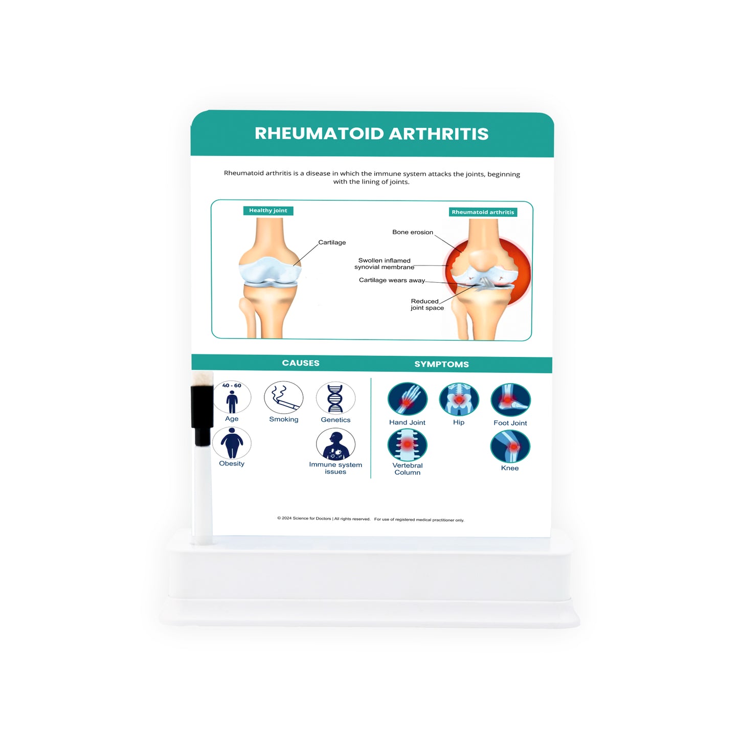 Rheumatoid Arthritis: 1 Slide on stand