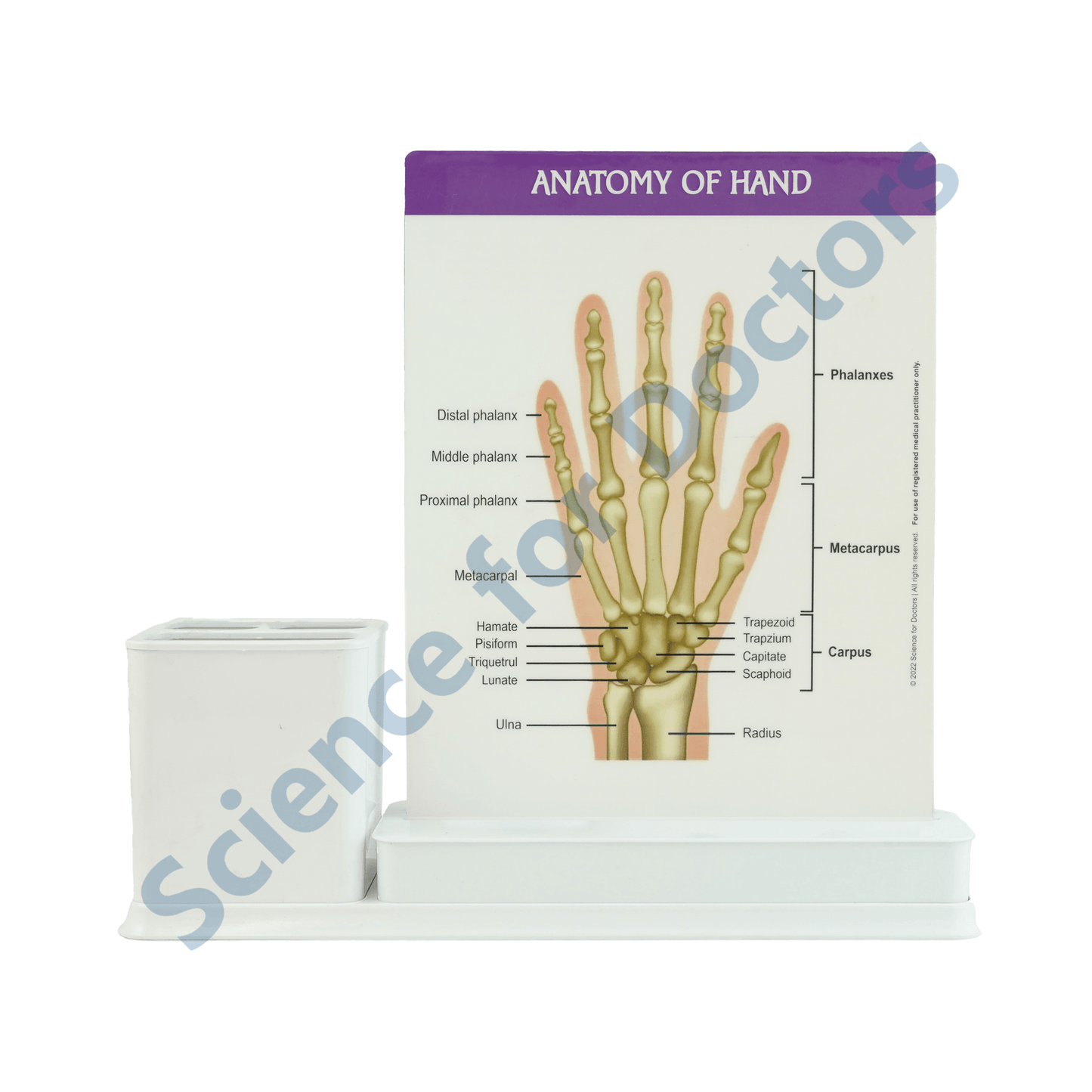 Rheumatoid Arthritis Hand: 1 Slides Write & Wipe with Stationary Stand