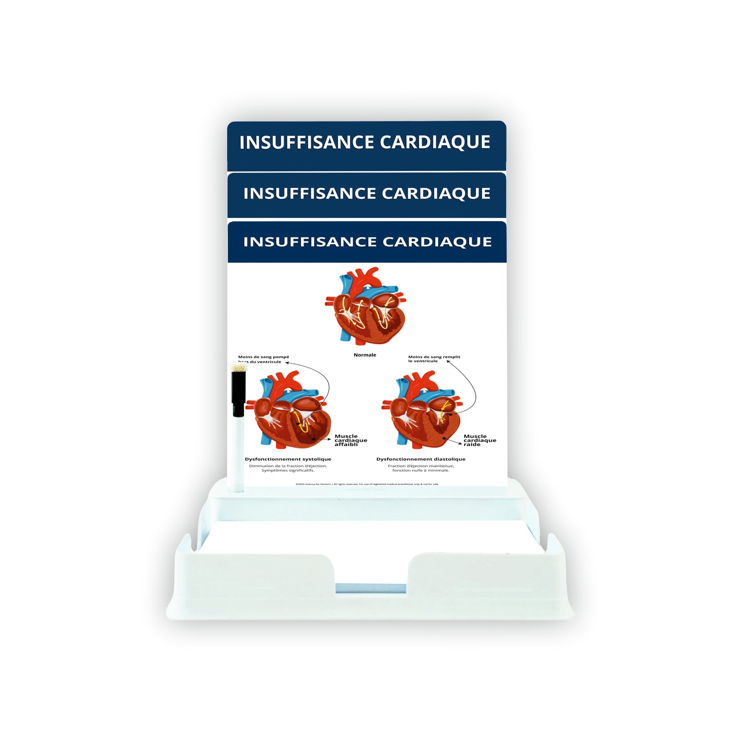 Heart Failure: 3 Slides With Tray