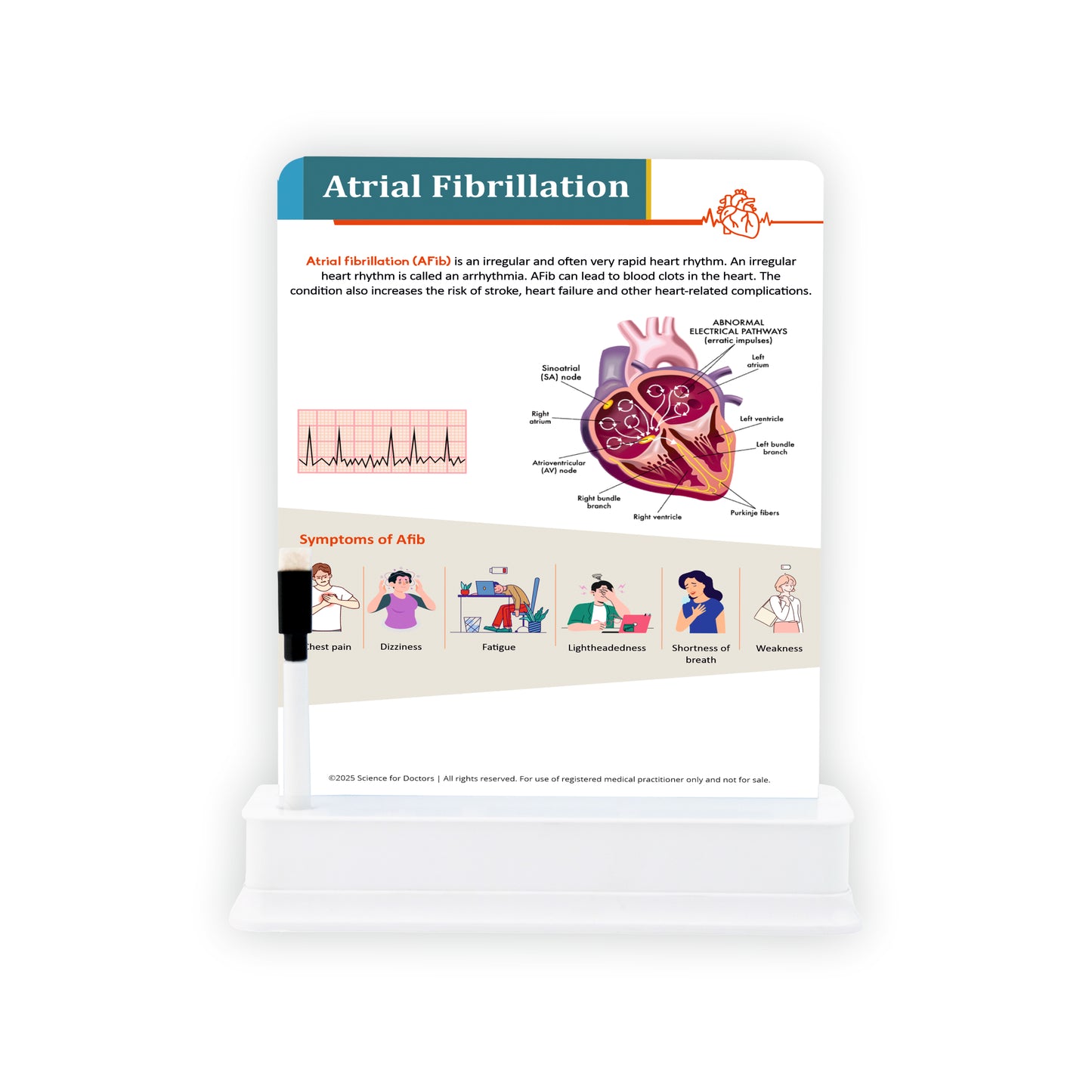 Atrial Fibrillation: 1 Slide With Stand