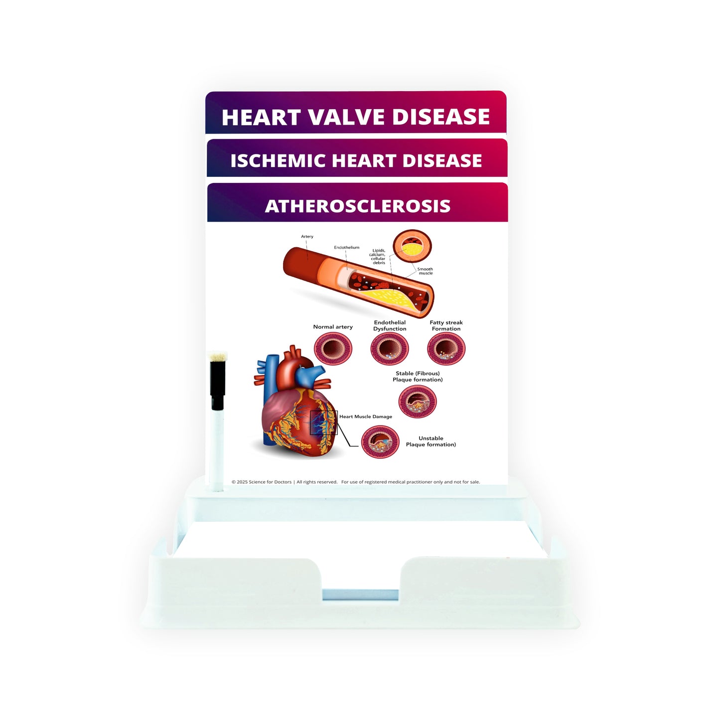 Atherosclerosis: 3 Slides With Tray