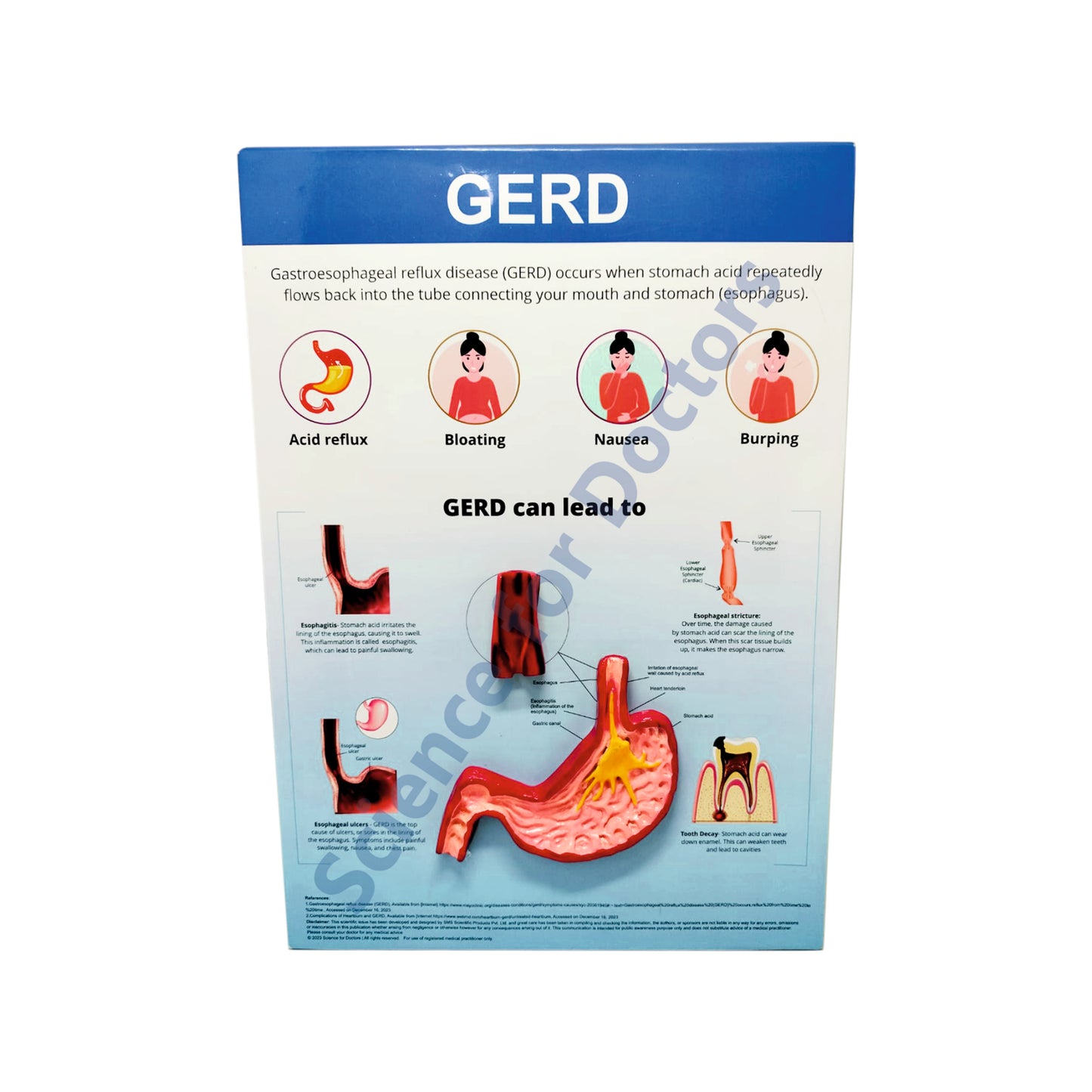 GERD: 3D Therapy Board
