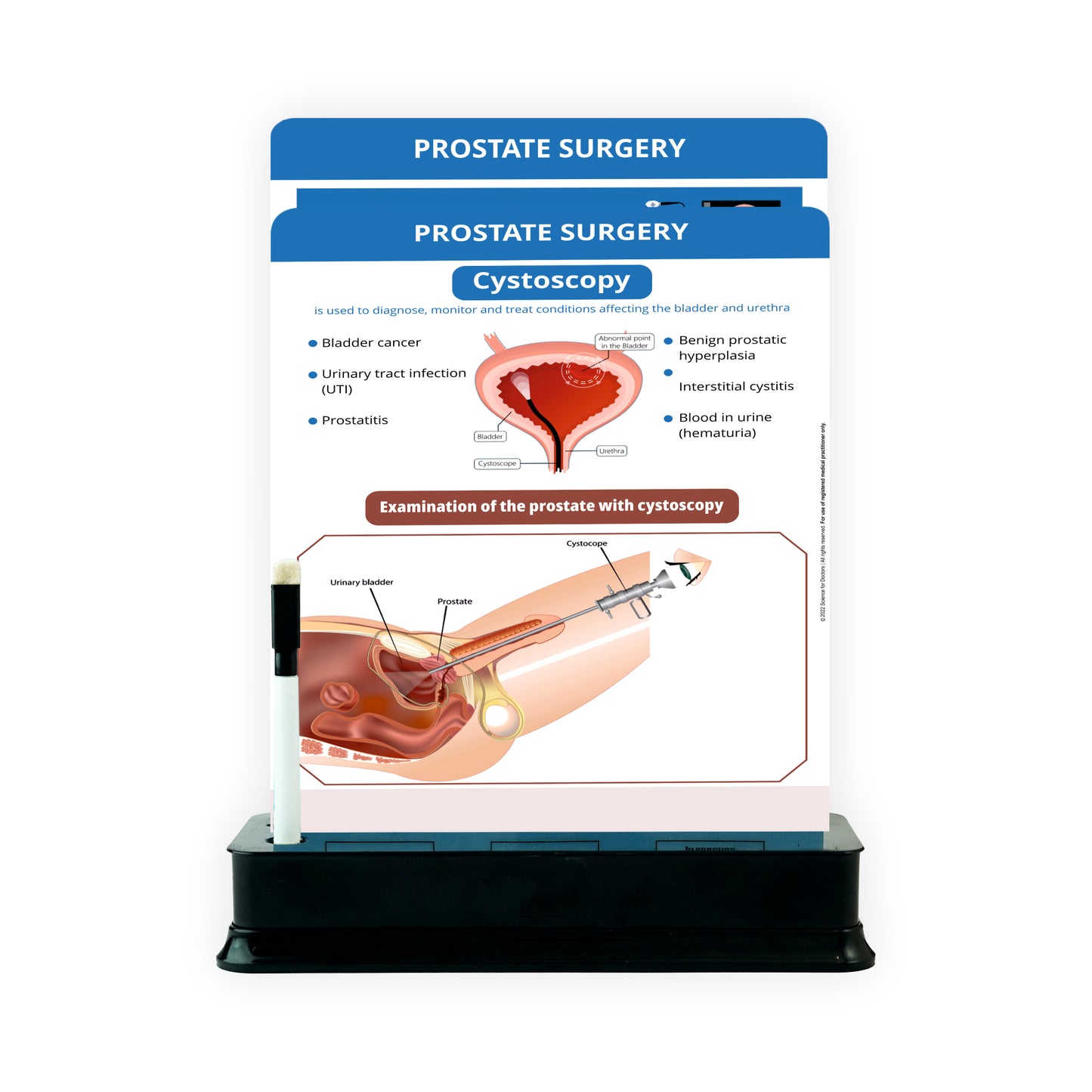 Prostate Surgery: 2 Slides With Stand