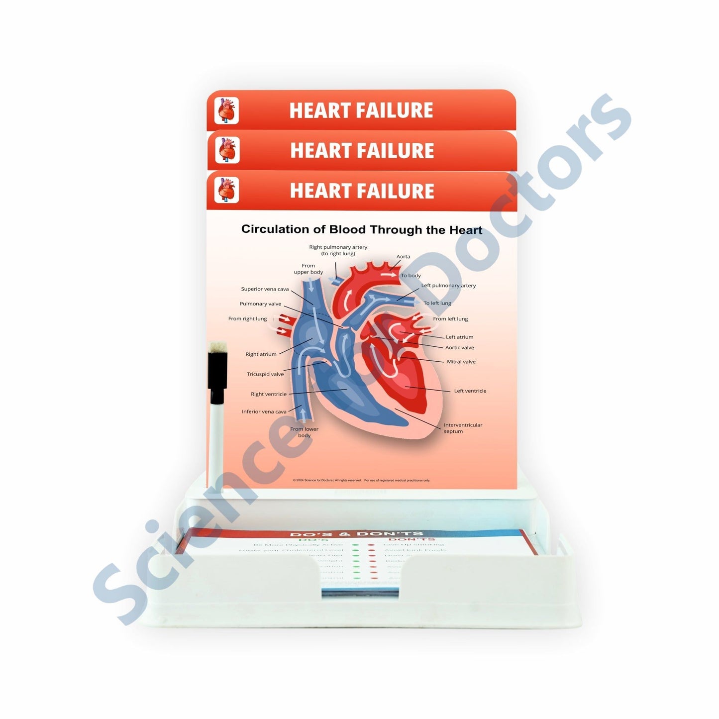 Heart Failure: 3 Slides Patient Leaflet Tray