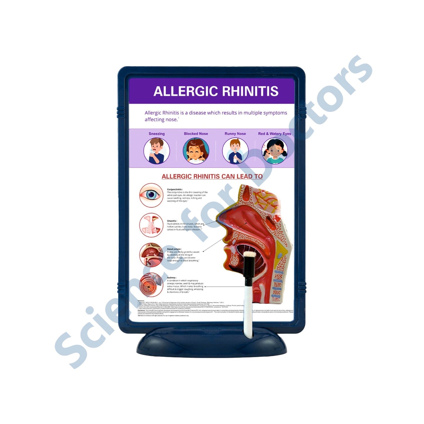 Allergic rhinitis: The Frame Write & Wipe