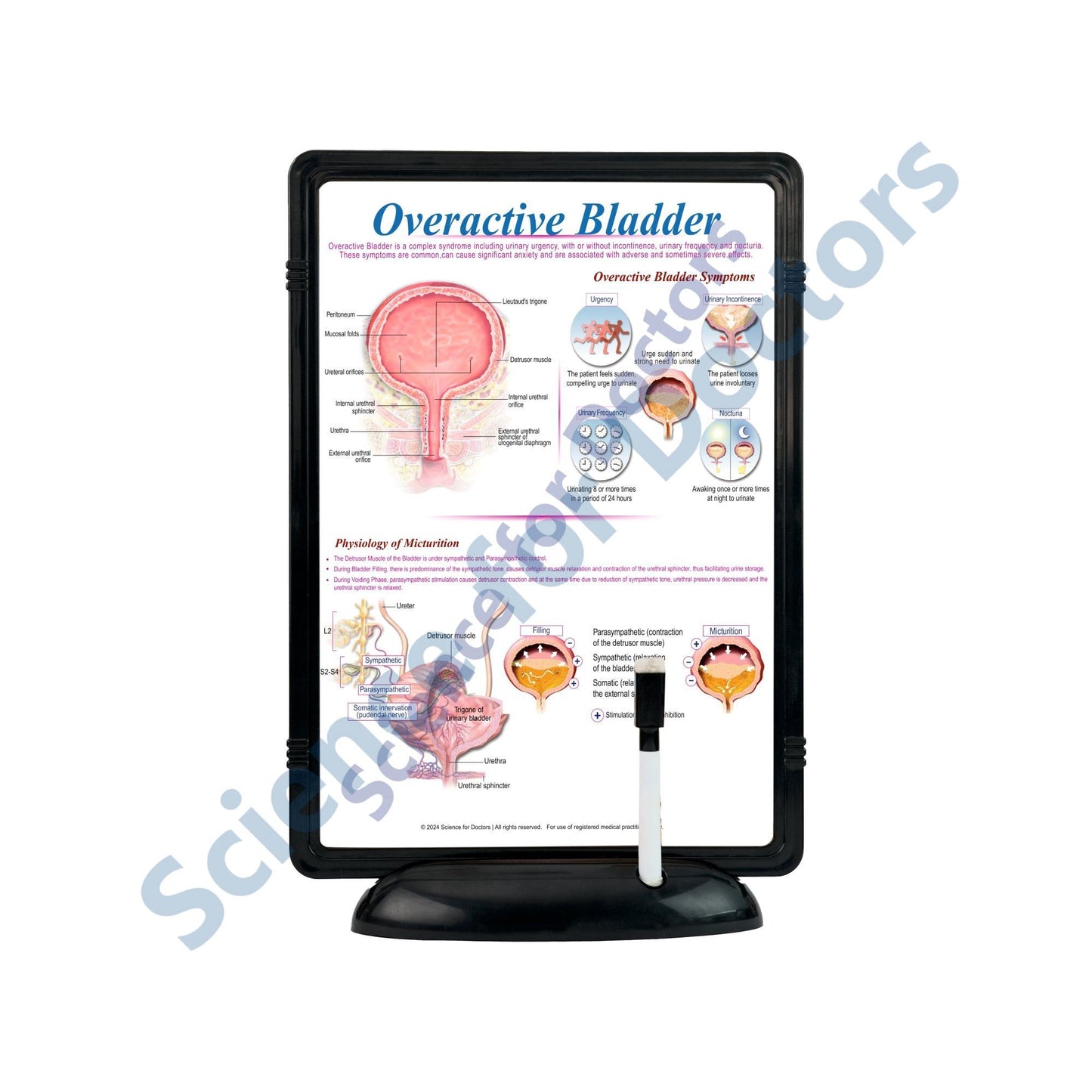 Overactive Bladder: The Frame Write & Wipe