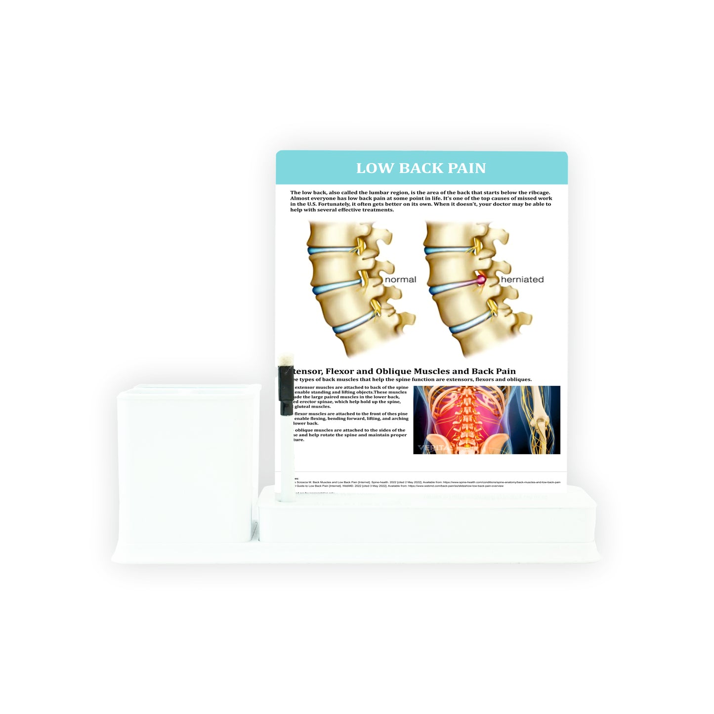 Low Back Pain: 1 Slides Write & Wipe with Stationary Stand