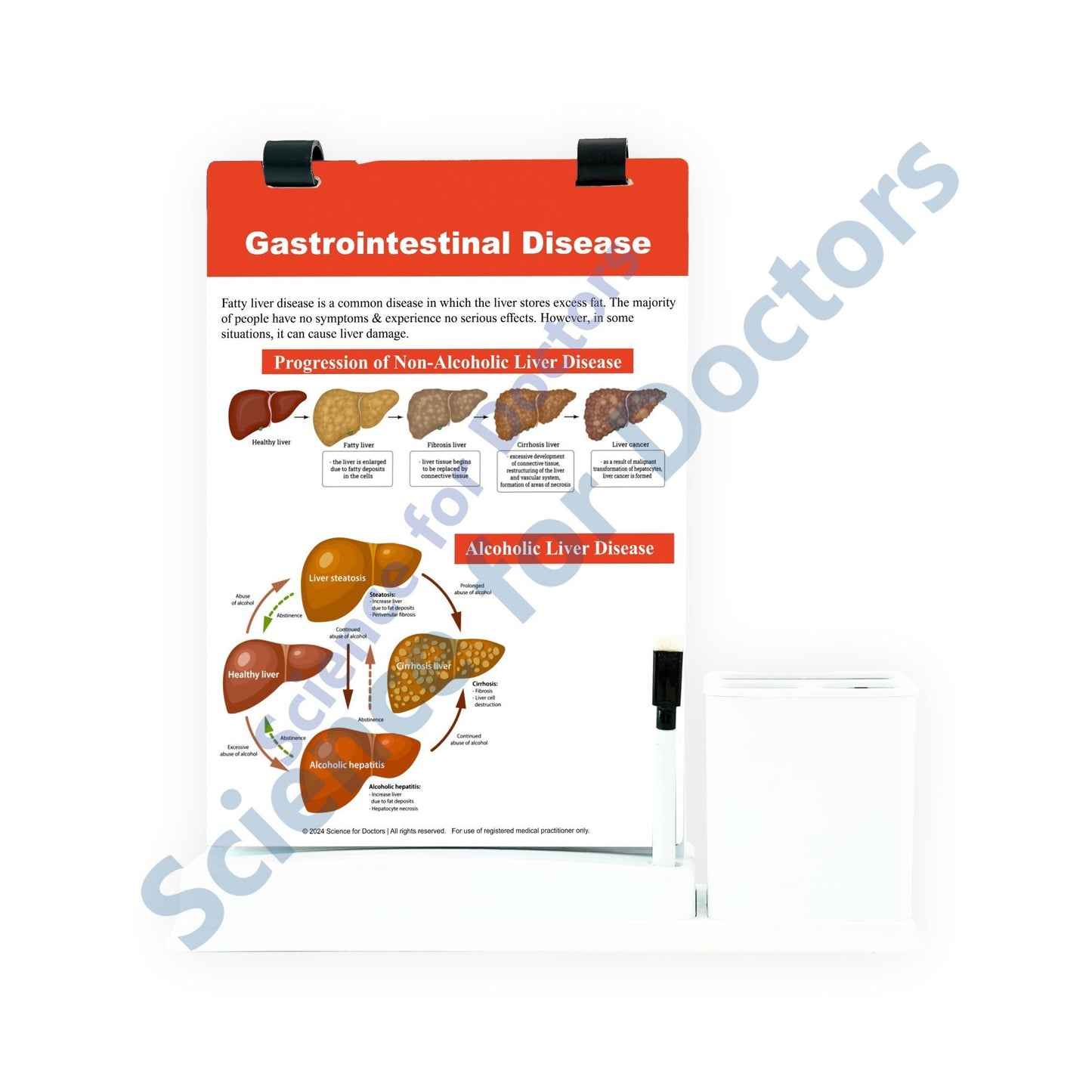 Gastrointestinal Disease: A4 Flip Wipe With Stationery Stand