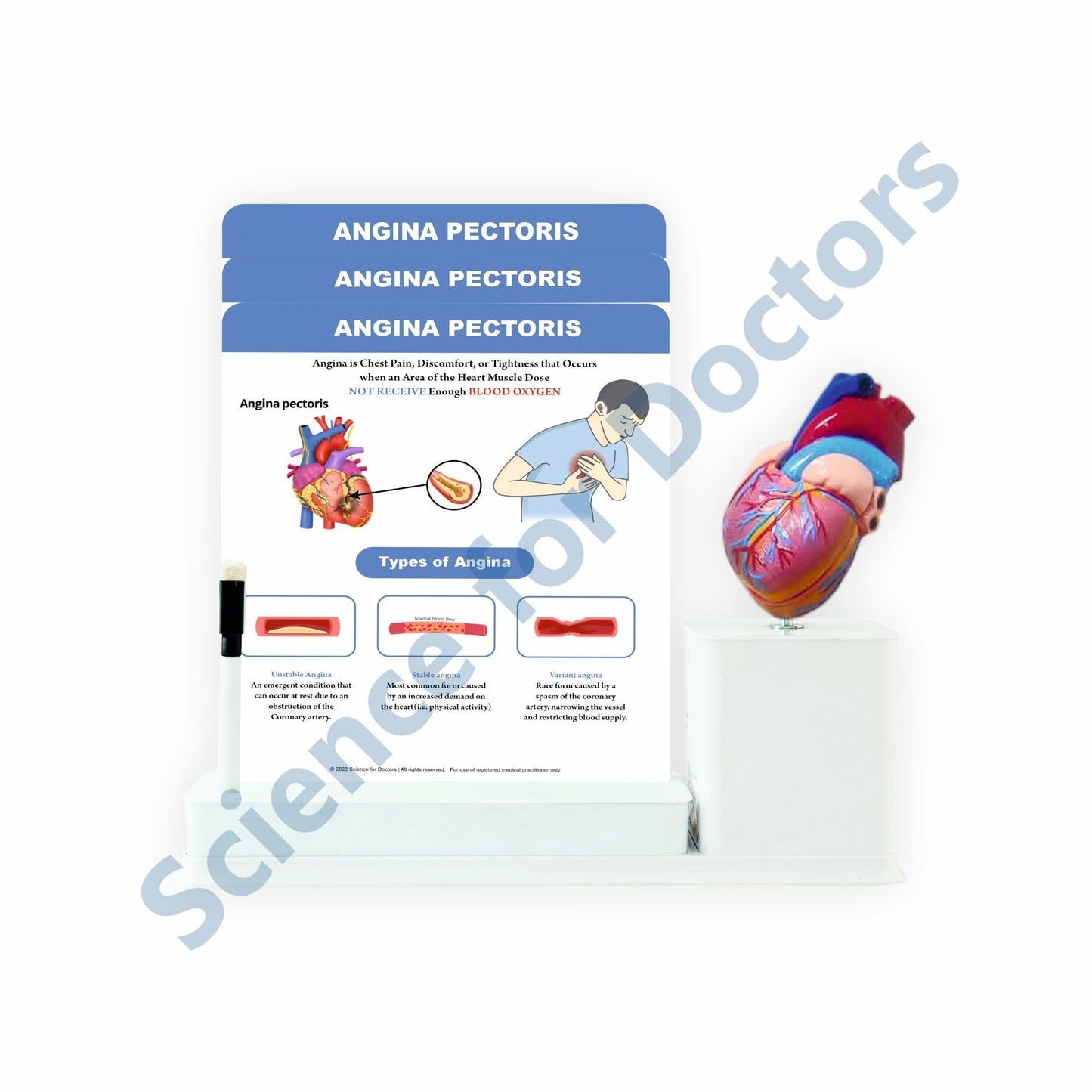 Angina Pectoris: 3 Slides Write & Wipe With Model On Stand