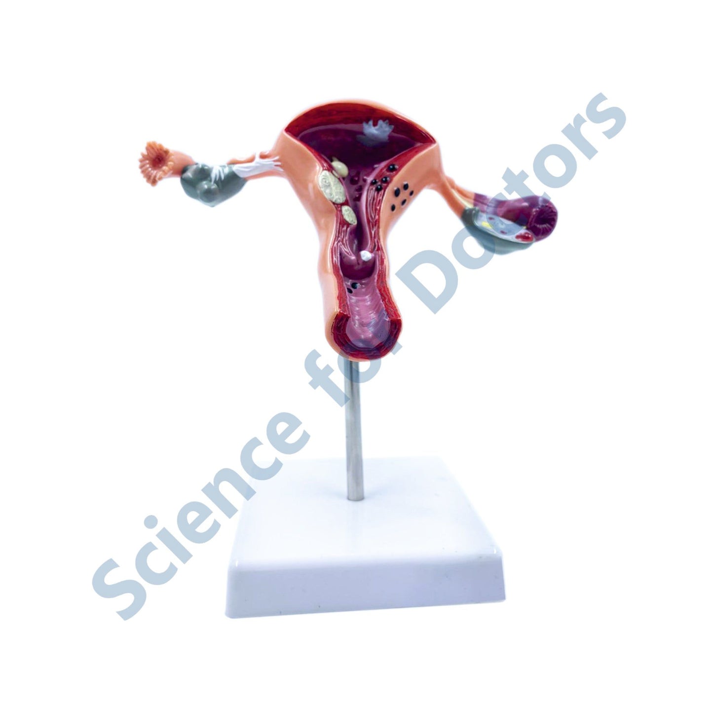 Uterus: 3D Anatomical Models