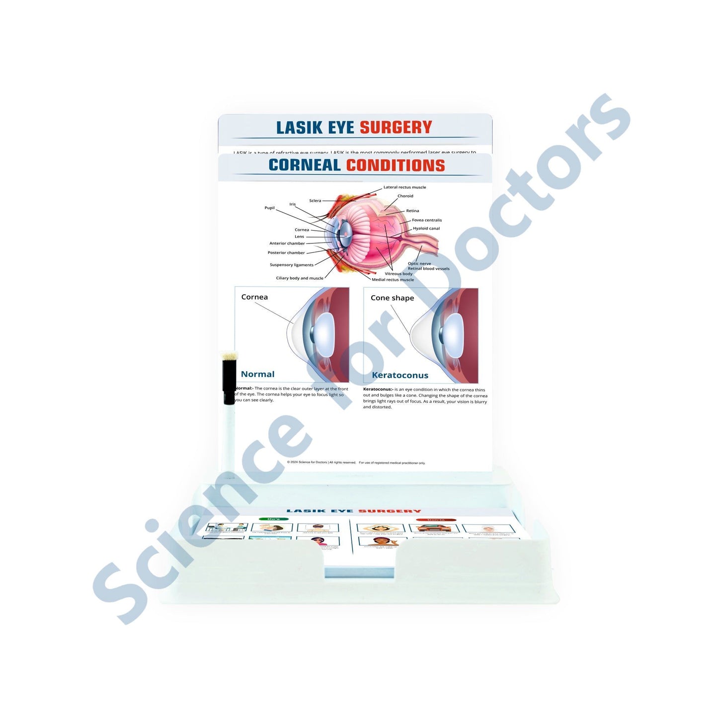 Corneal Conditions: 2 Slides Patient Leaflet Tray