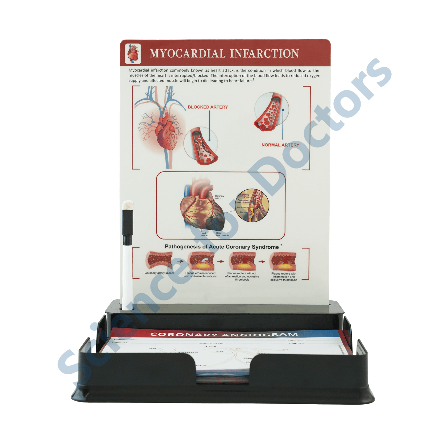 Myocardial infarction: One slide with Tray