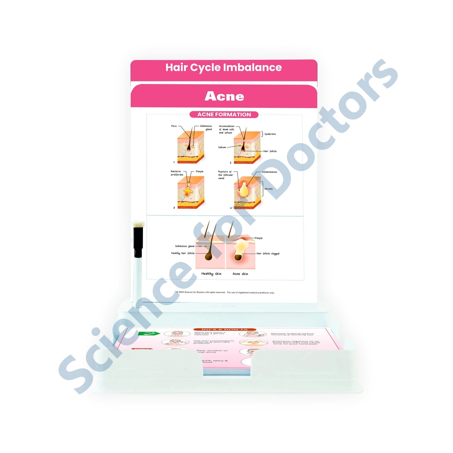 ACNE: 2 Slides Patient Leaflet Tray