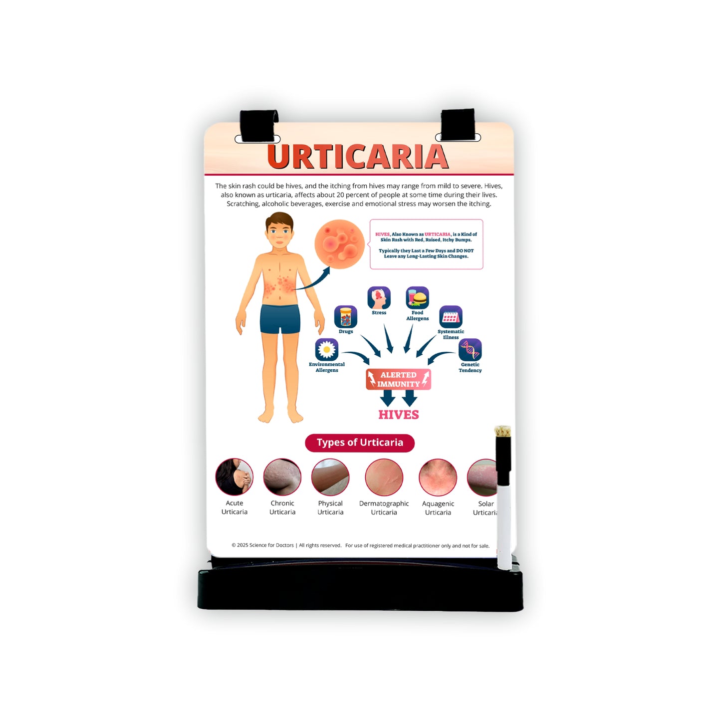 Urticaria: A4 Flip Wipe